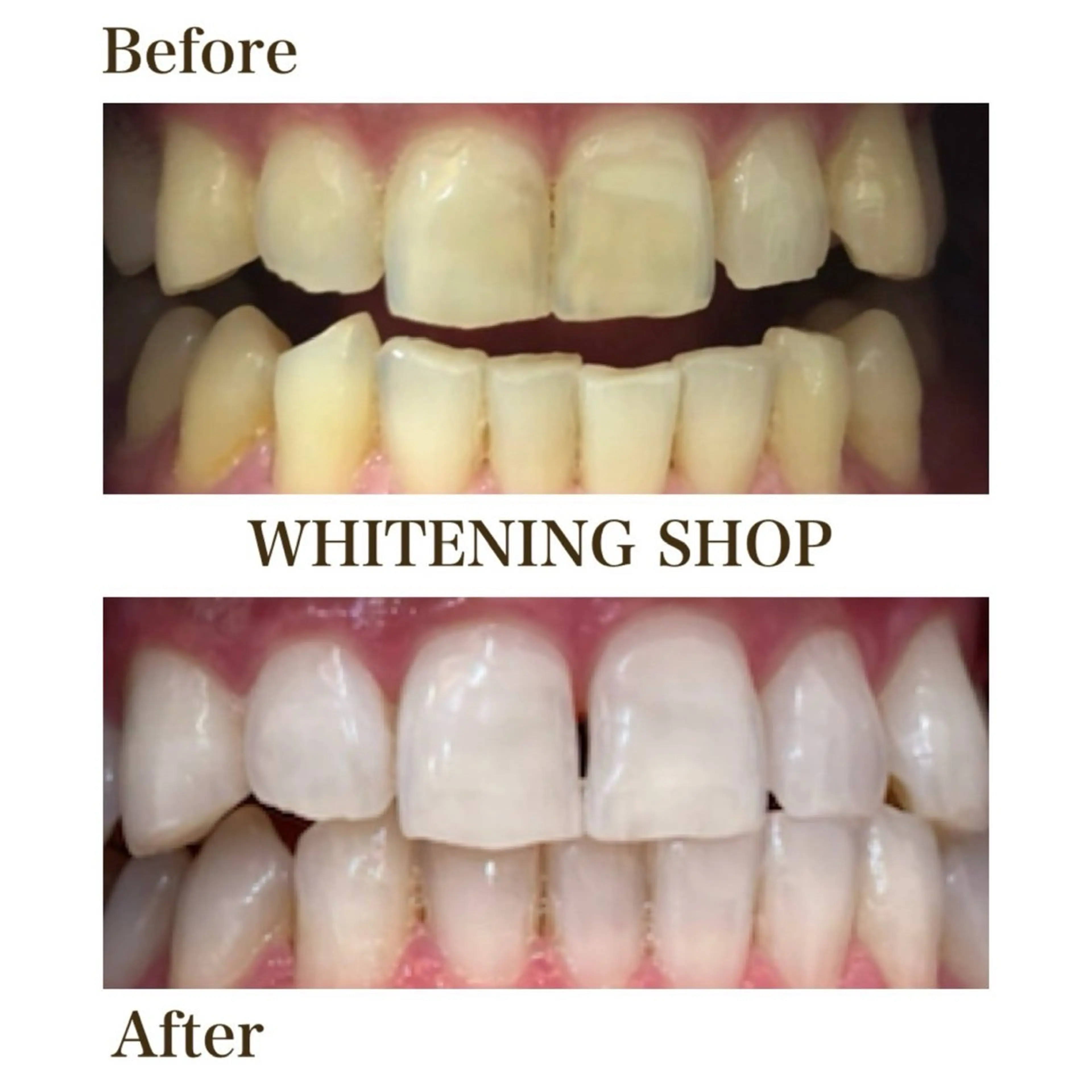 その他 ホワイトニングショップ静岡葵区店所属・ホワイトニング ショップ葵区静岡駅店のその他イメージ