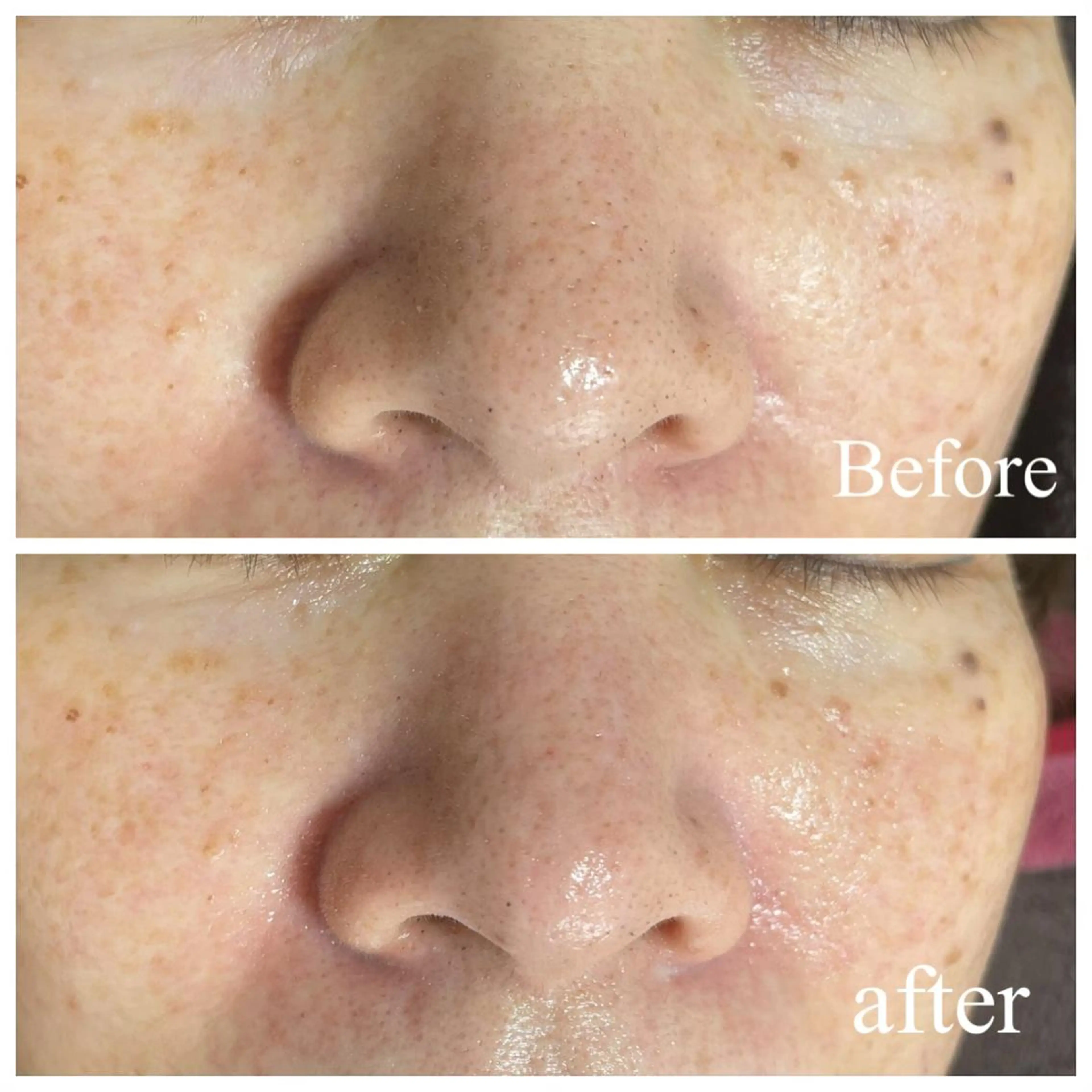 肌質改善サロン facialmoonのエステ・リラクイメージ