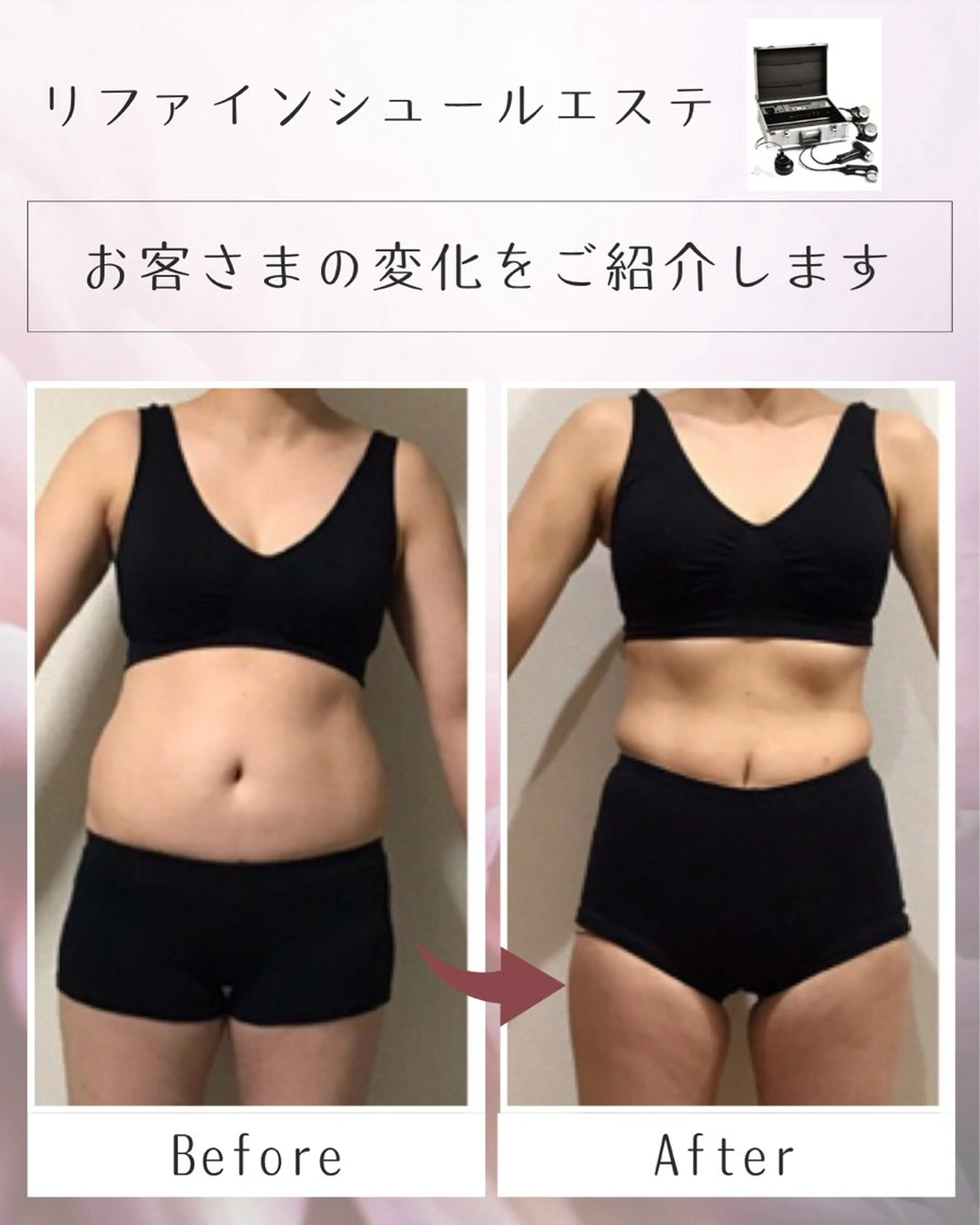 🌈女性限定🌈 気になるお腹まわりを集中的にケア✨の写真