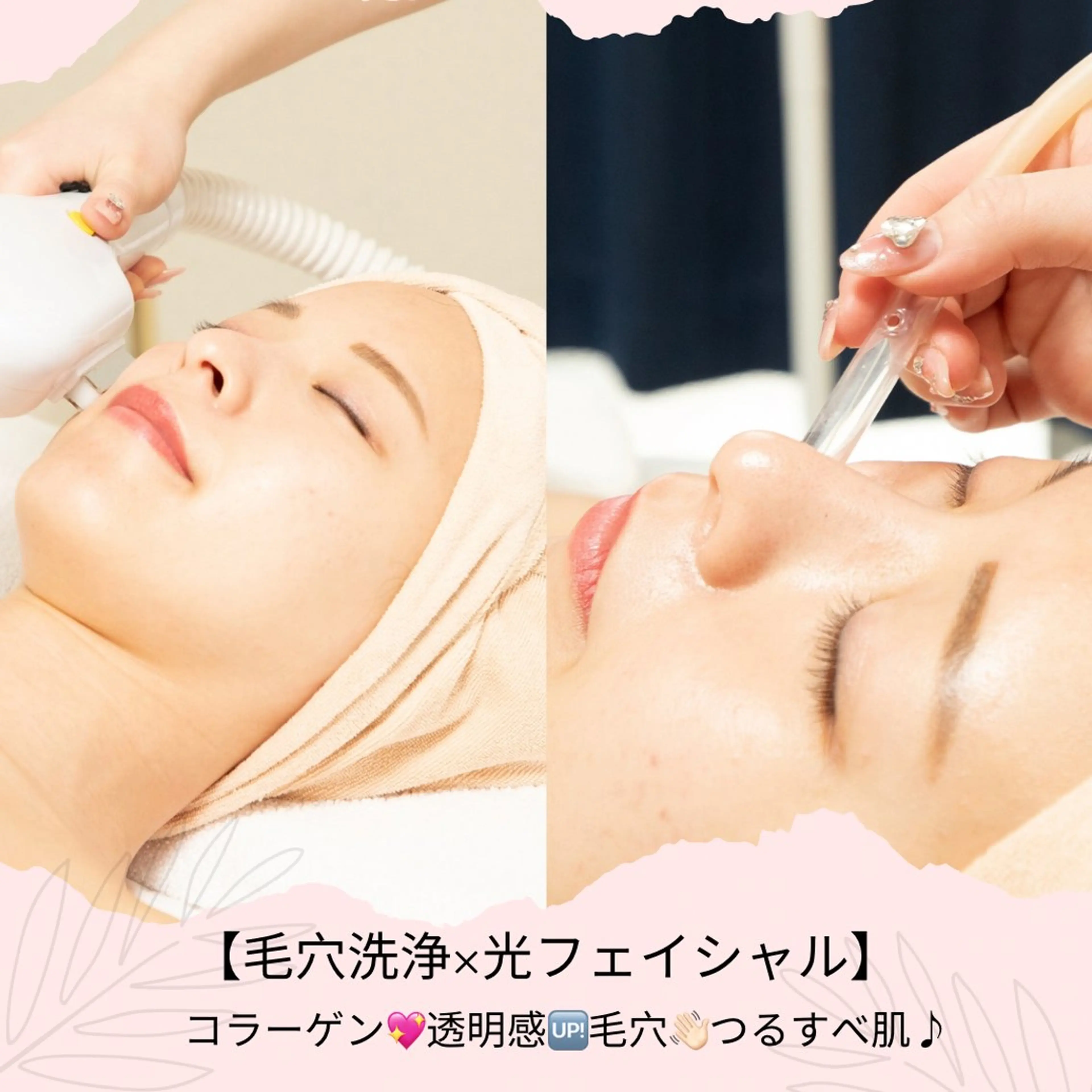 Palum Airiのその他イメージ