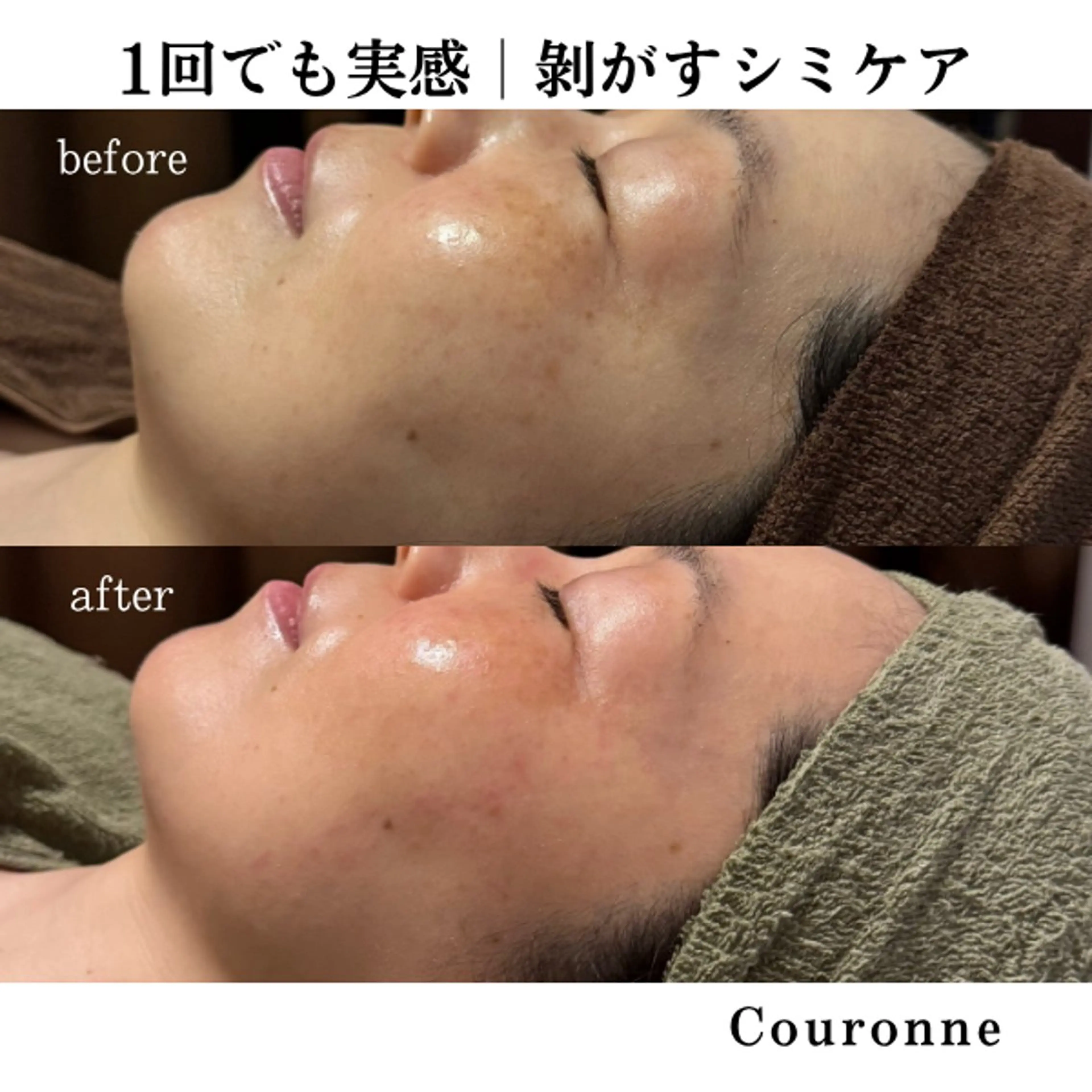 エステ シミ・毛穴ケア専門 クロヌYUKIのエステ・リラクイメージ