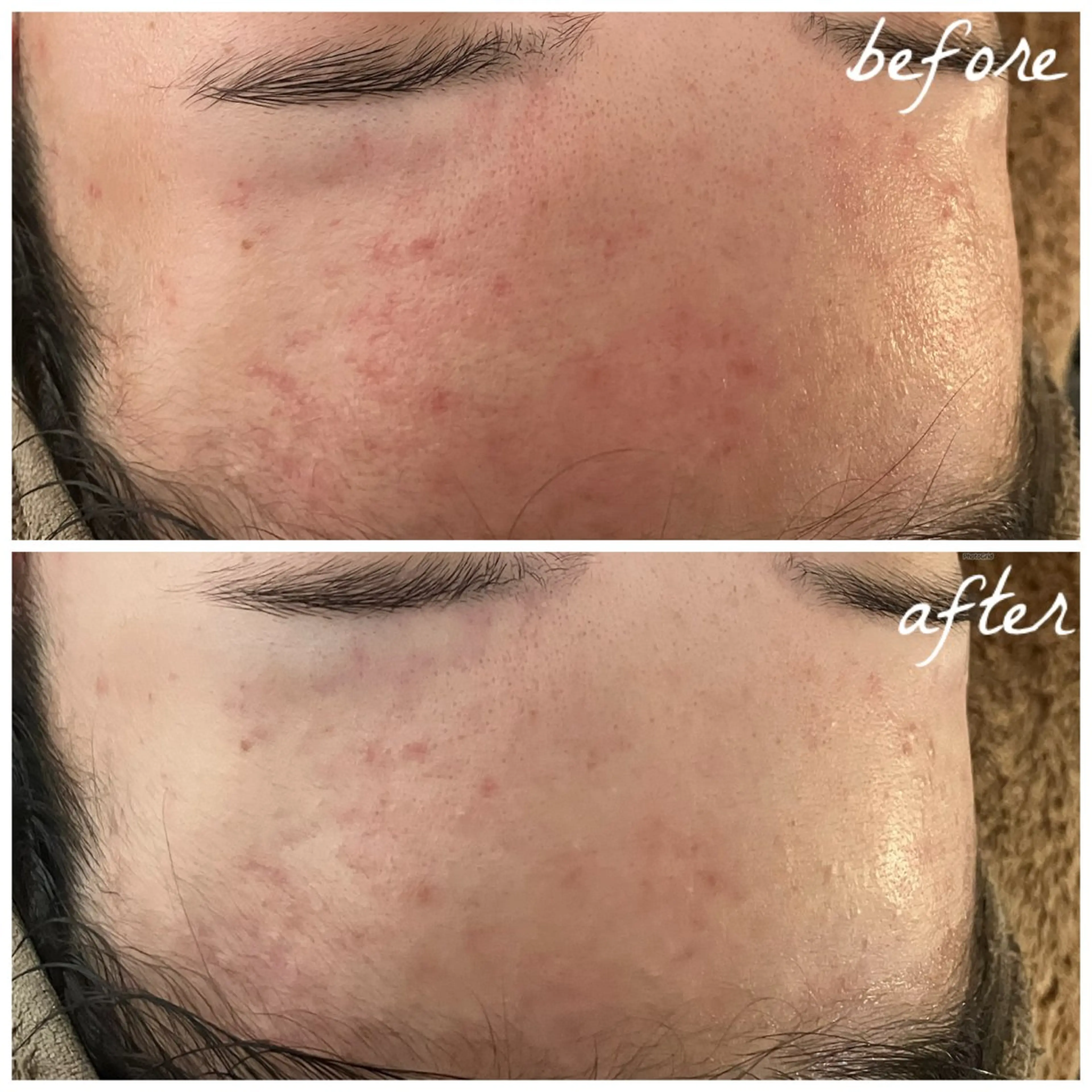 メンズ エステ メナード岐阜茜部 杉浦のエステ・リラクイメージ