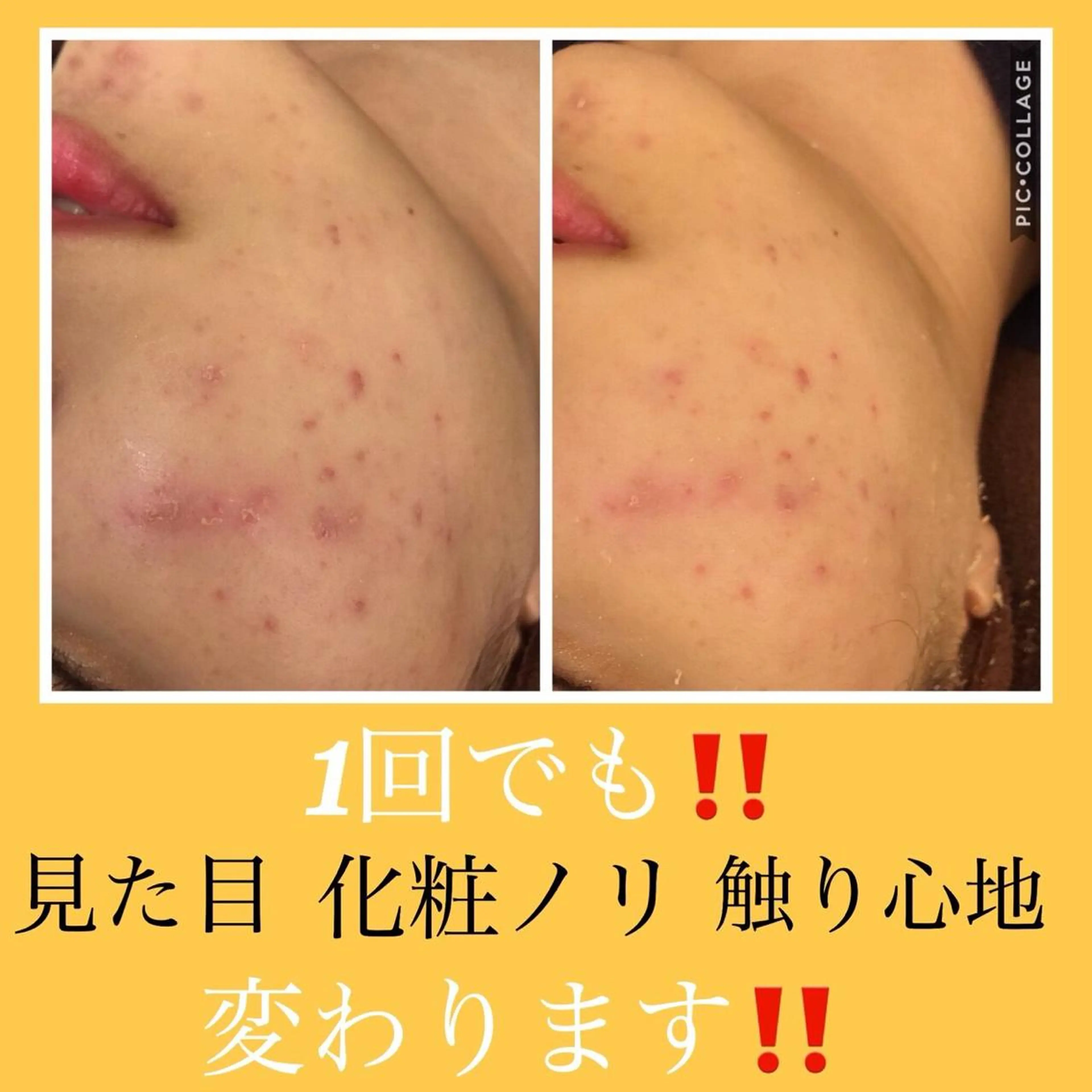 ミディアム カラー パーマ ヘアアレンジ メンズ キッズ ネイル マツエク・マツパ ニキビ・肌質改善専門 ♡人生が変わるサロンのエステ・リラクイメージ