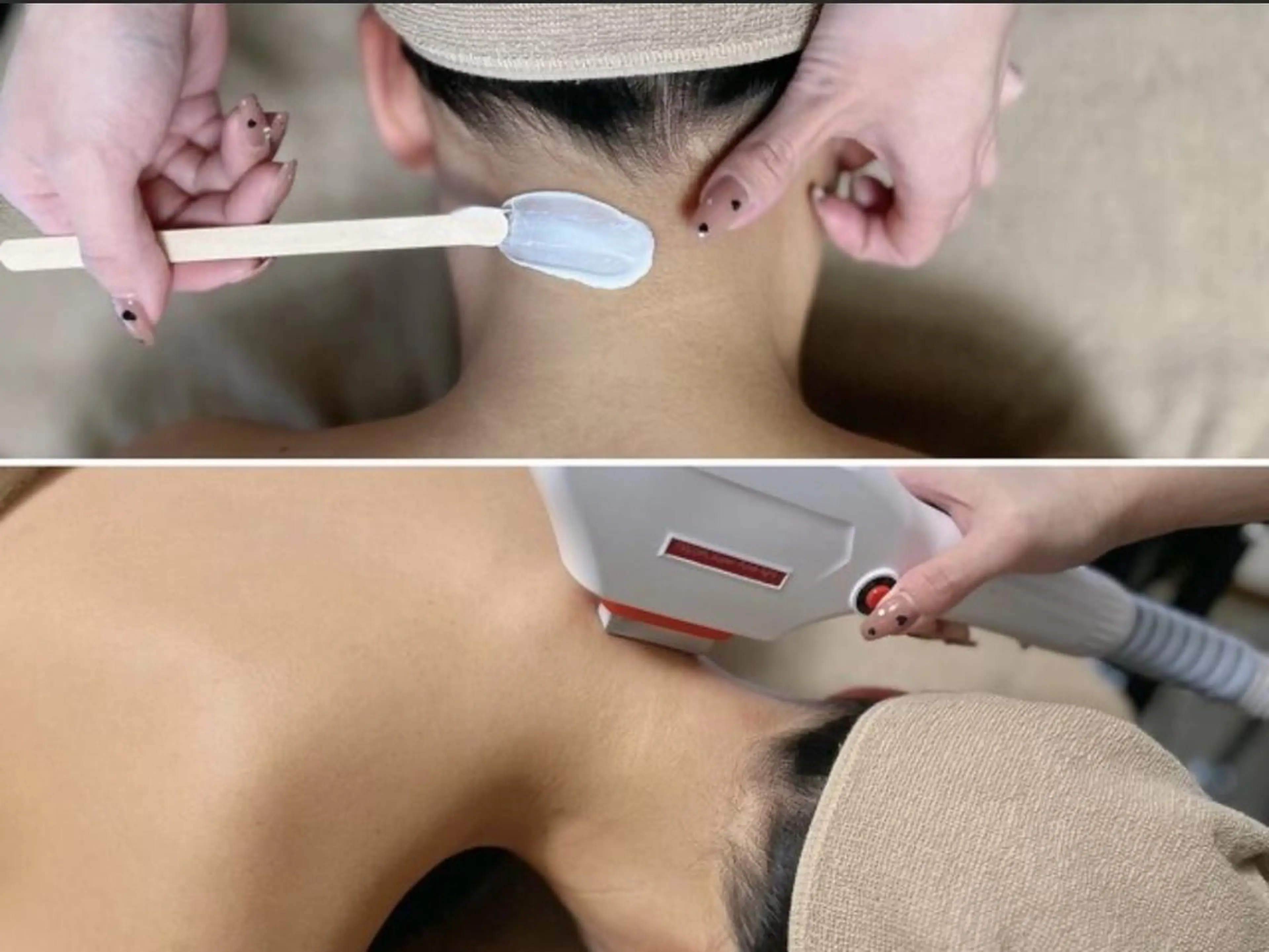 メンズ キッズ 脱毛 Epina 千葉店 【エピナ】のエステ・リラクイメージ