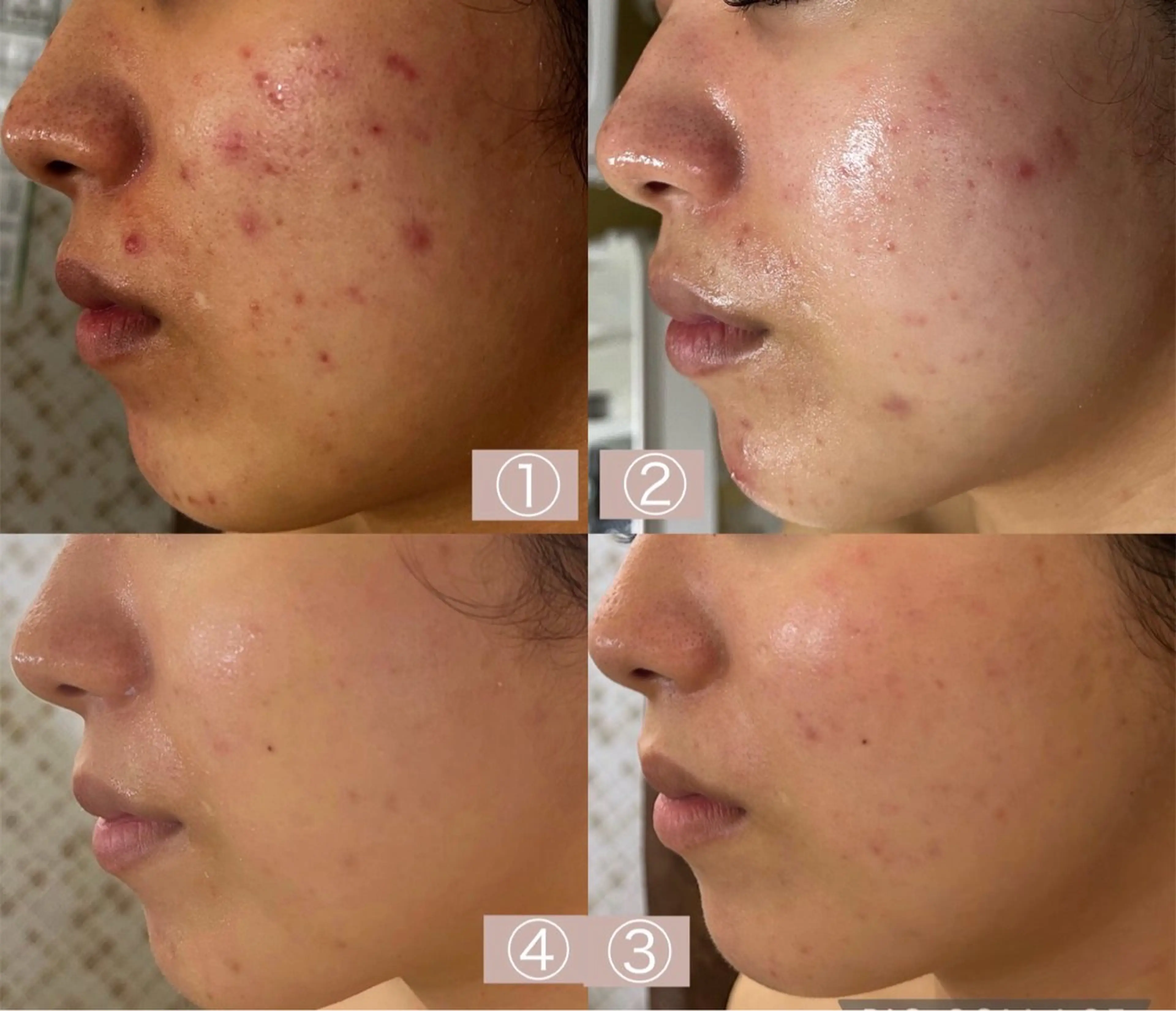 小顔&美肌品川店 Masqueradeのエステ・リラクイメージ