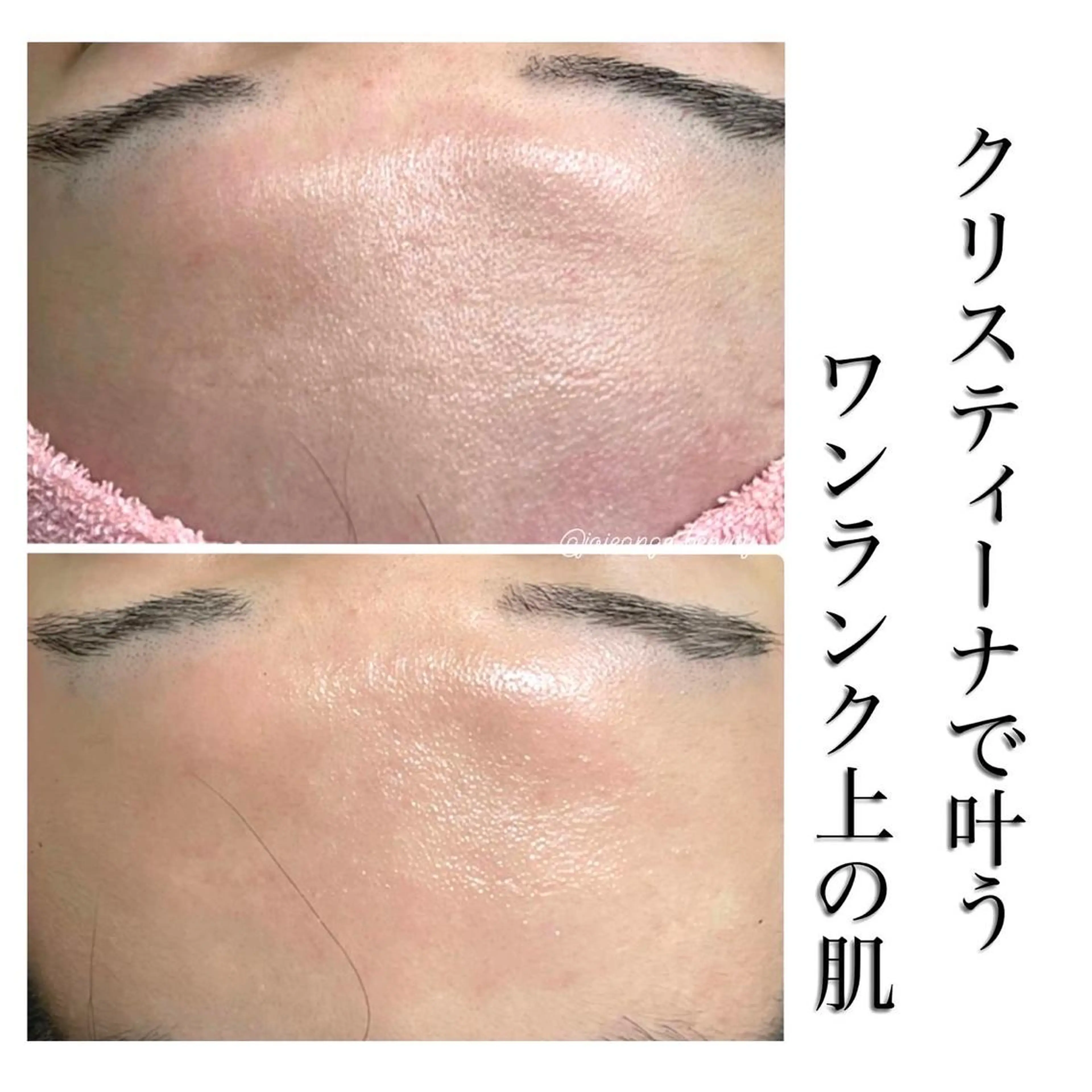 エステ矢野 ジョアアンジェ心斎橋のエステ・リラクイメージ