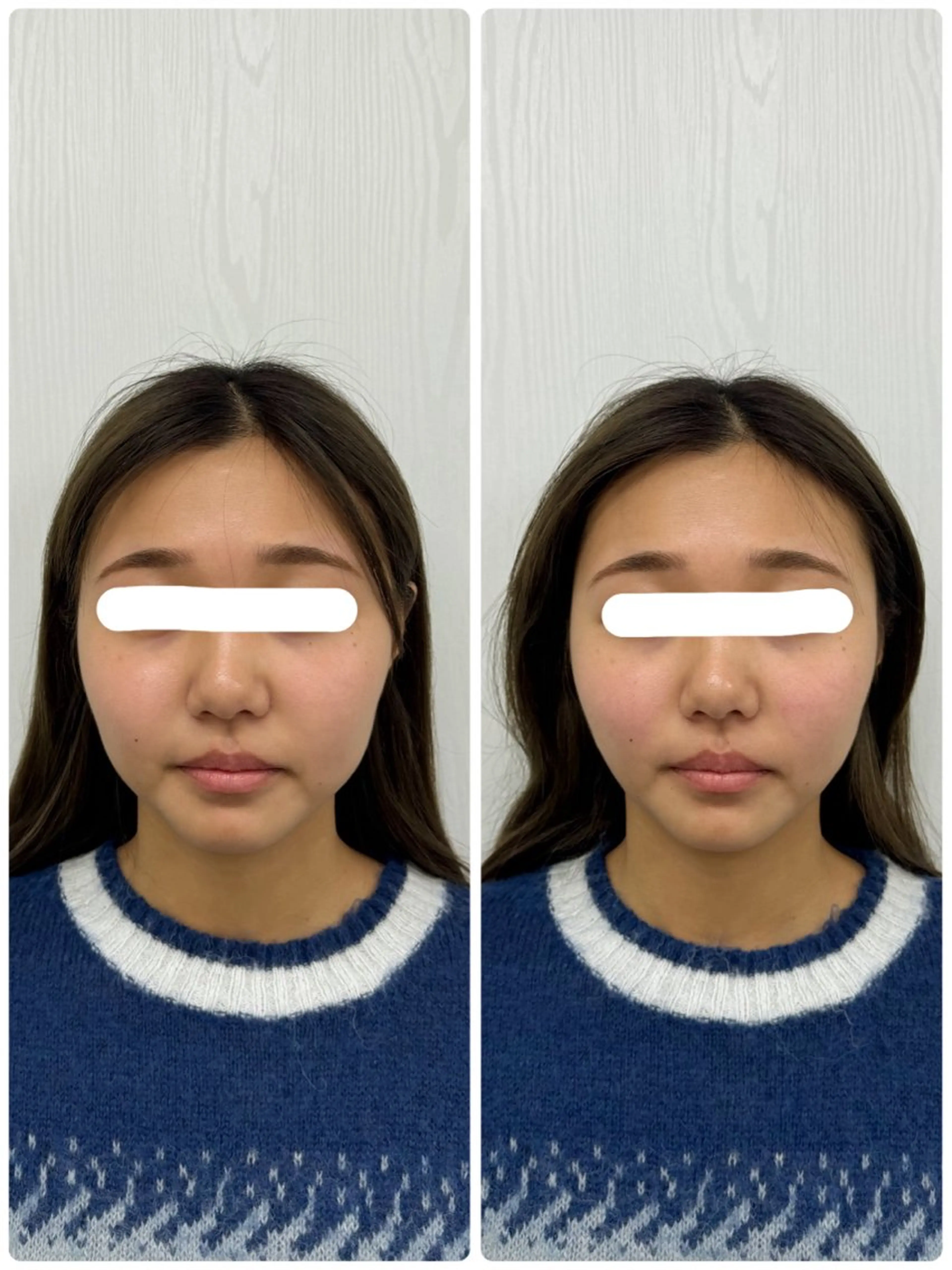 エステ リラク 美容鍼×小顔矯正 ×美容整体 浜川泰仁のエステ・リラクイメージ