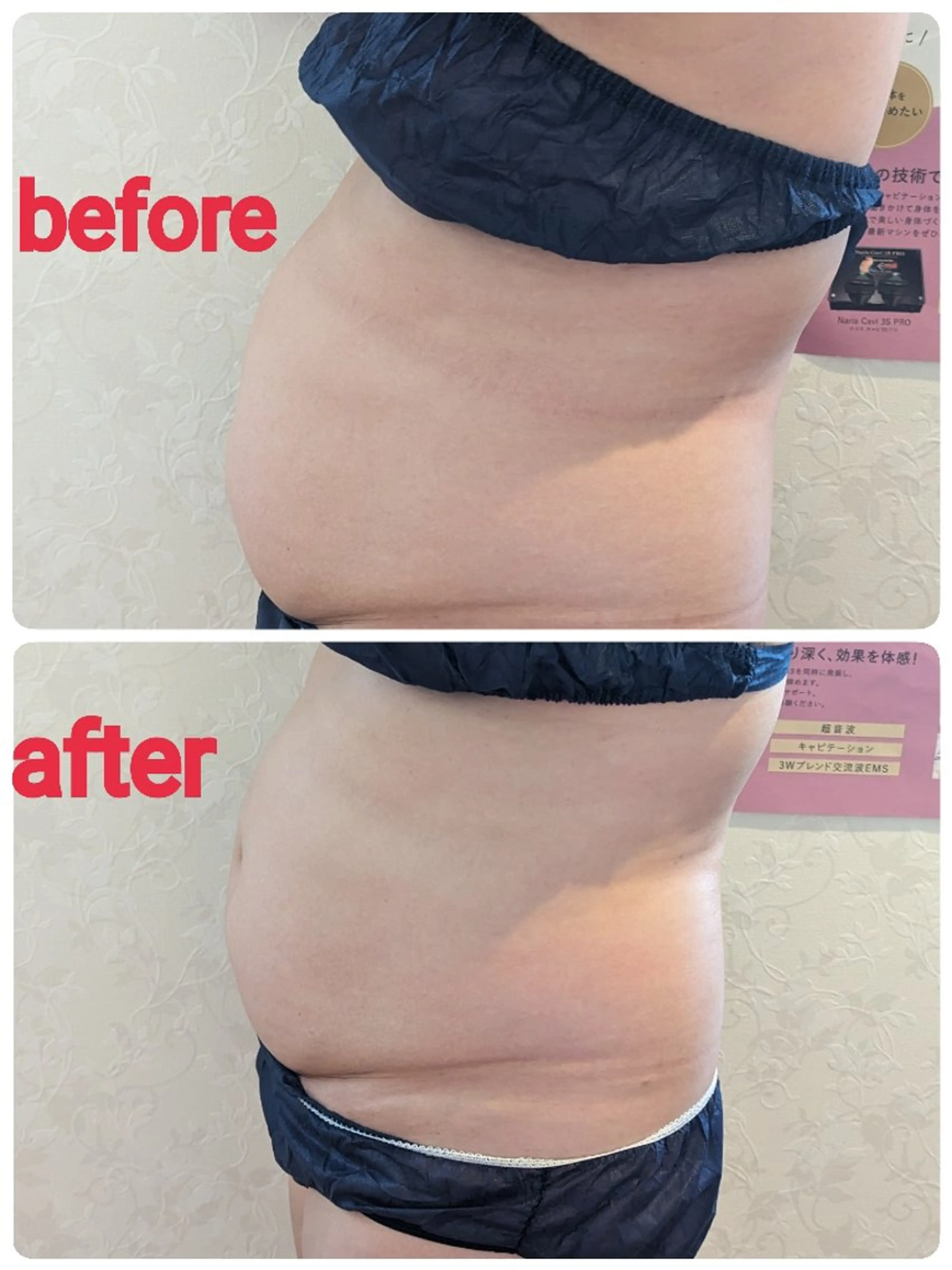 ユテラ 佑來（ゆき）のエステ・リラクイメージ