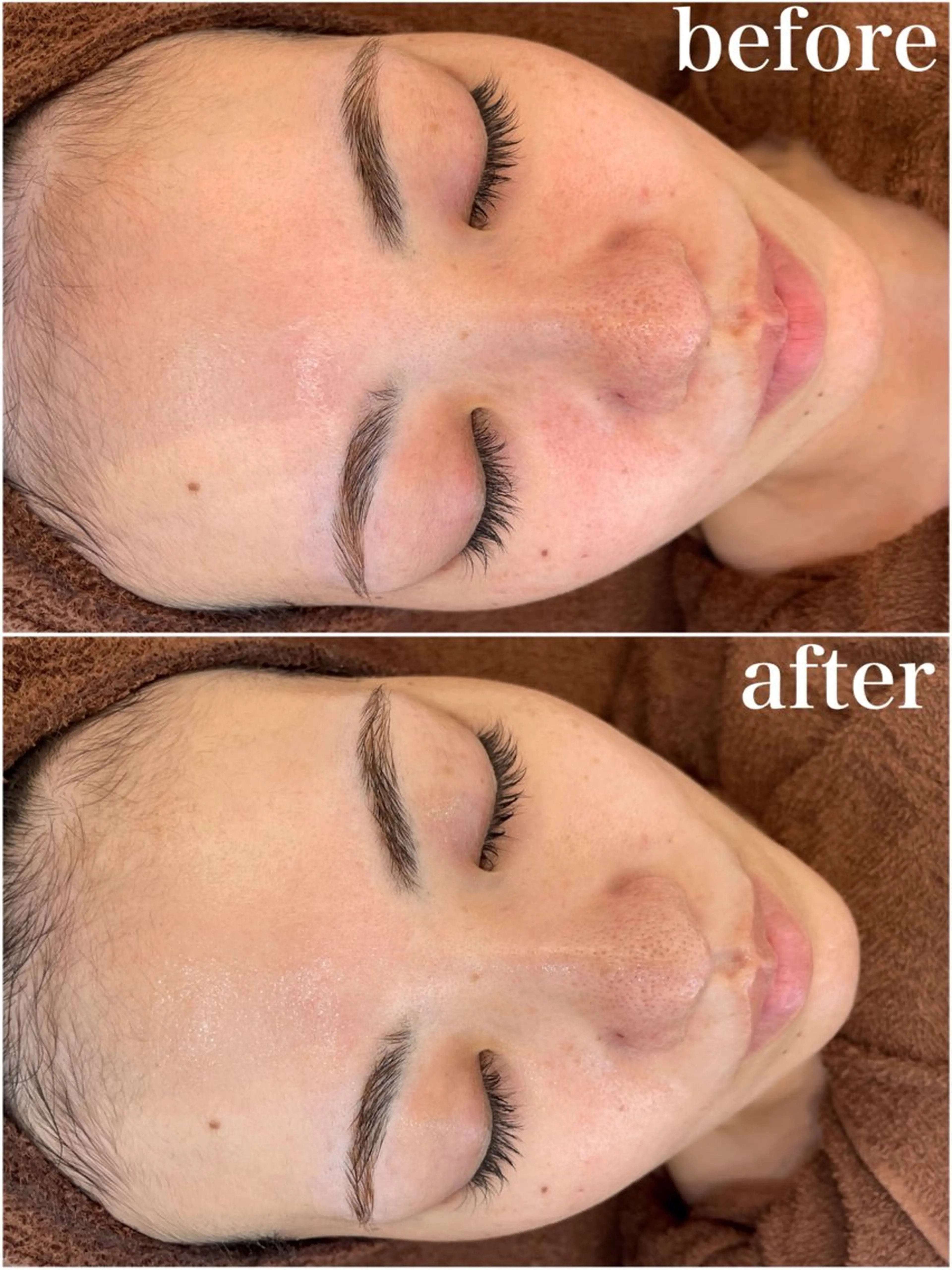 エステ リラク パーソナルスキンケア 🦋APRI🅿️有のエステ・リラクイメージ