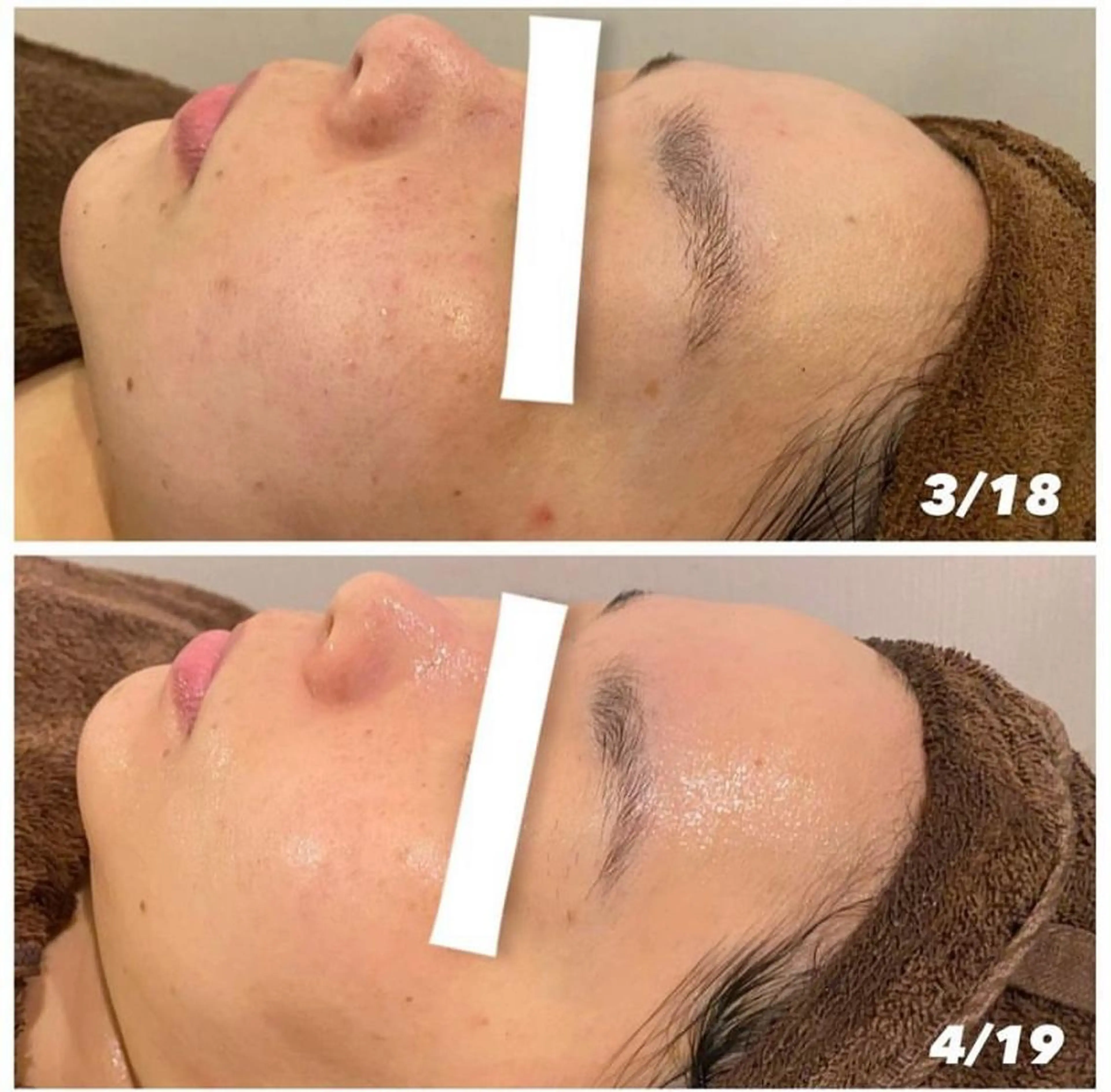 本気の肌質改善スキン デトックス🌿のエステ・リラクイメージ