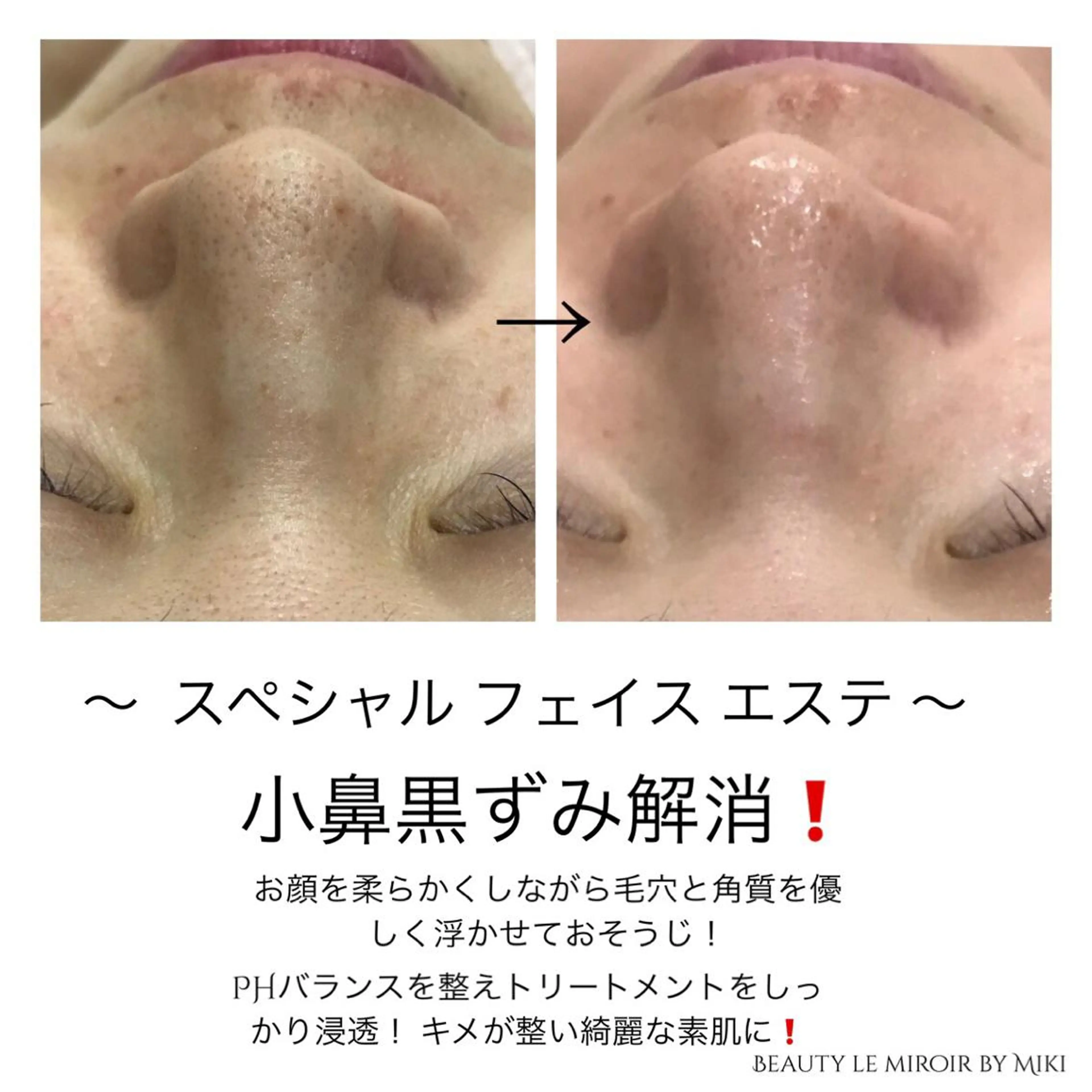 ビューティー ミロワールのエステ・リラクイメージ