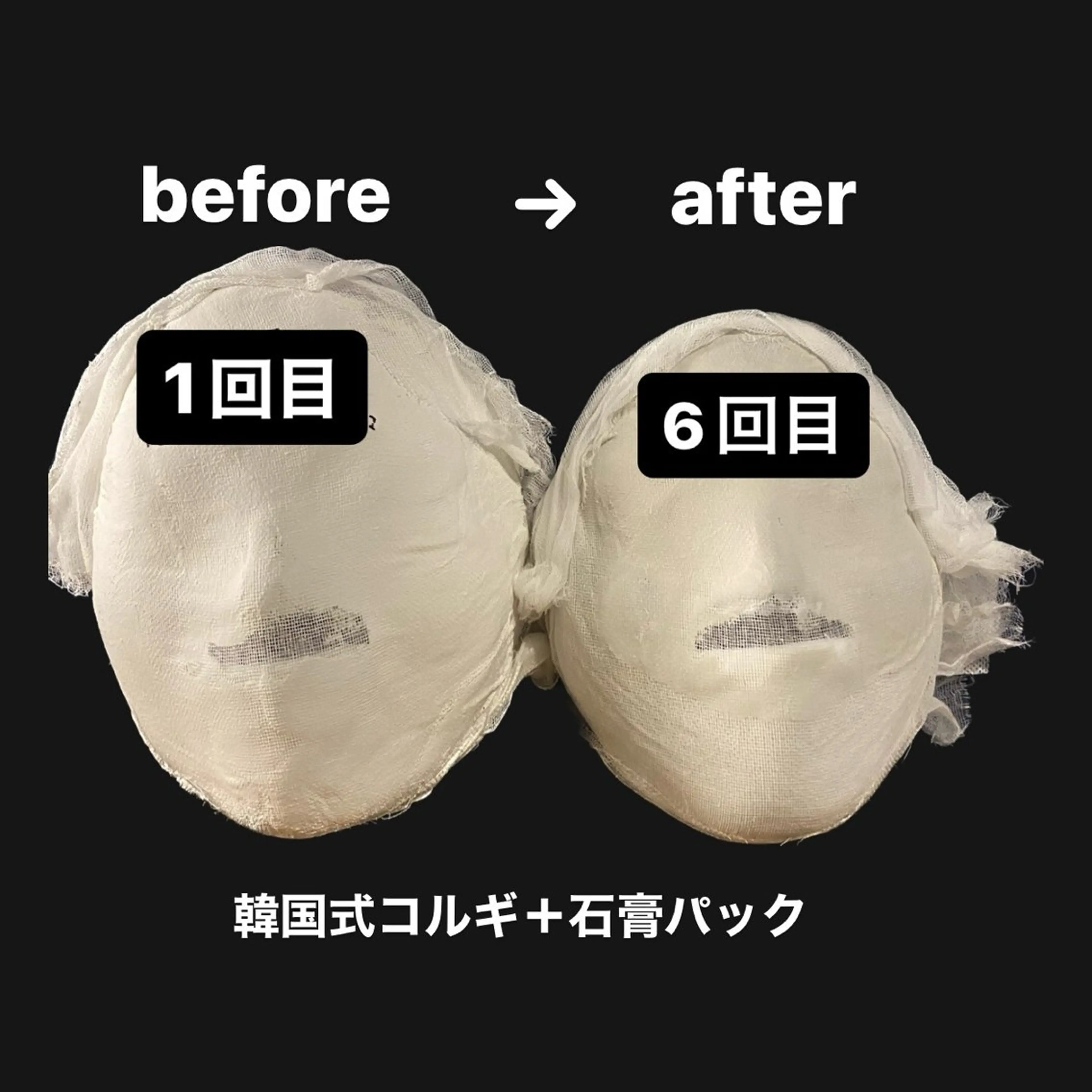 韓国式コルギ　オルチャン（フェイシャル）💆‍♀️の写真
