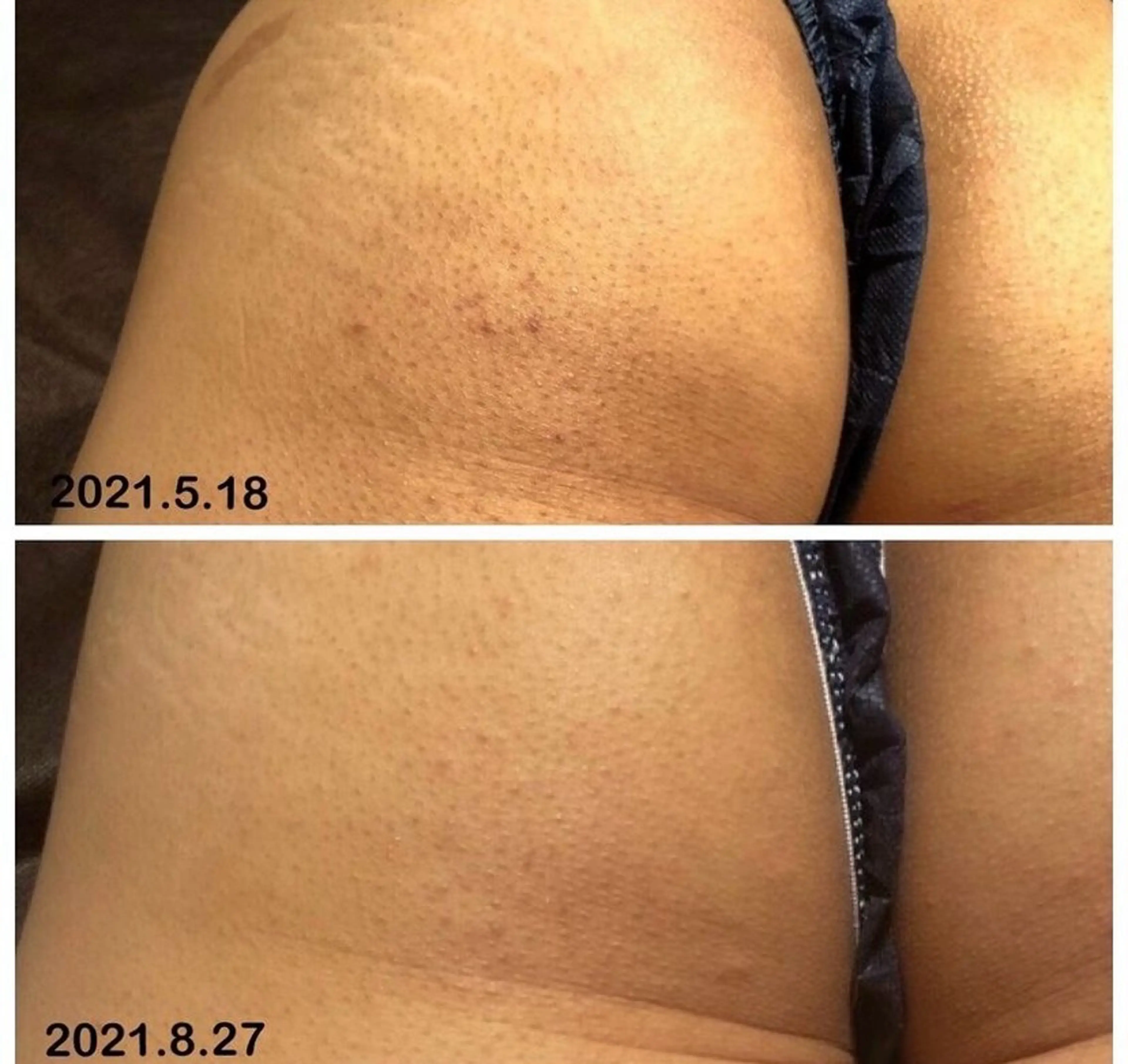 エステ セルライトクラッシュ ＆腸もみ＋骨盤矯正のエステ・リラクイメージ