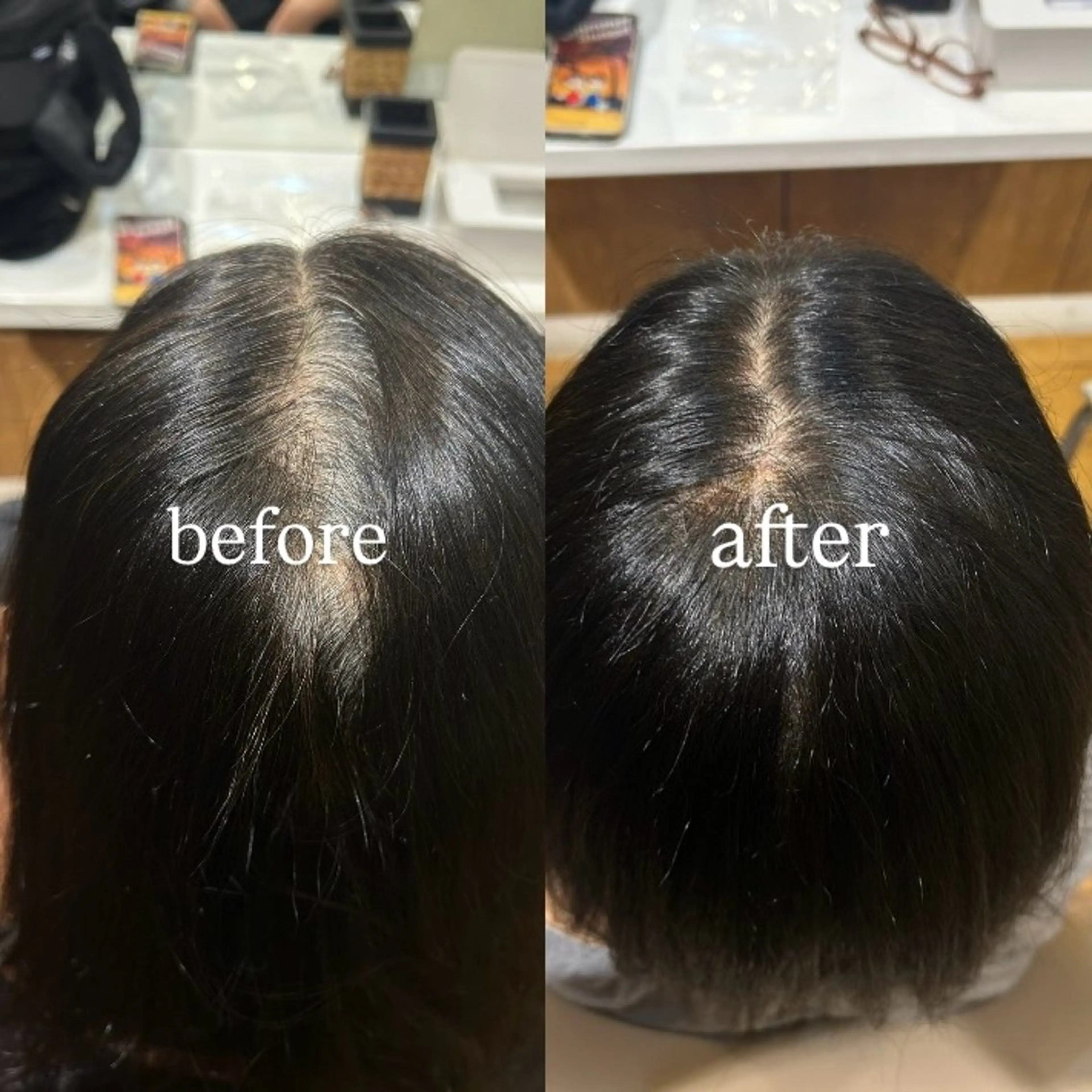 カラー 根本 琴子のヘアスタイル