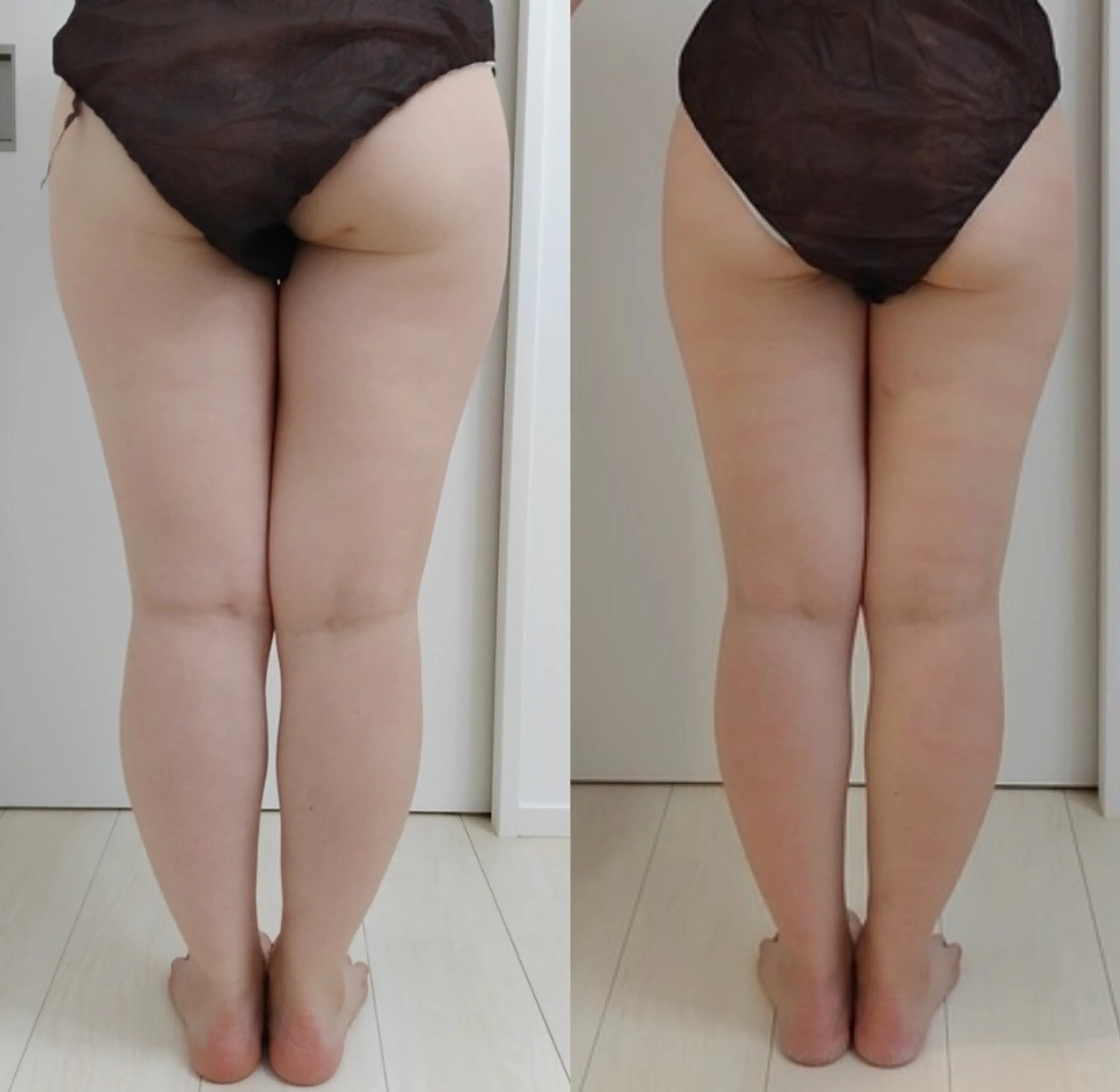 エステ リラク ユニセックスエステサロンUniclear所属・佐賀💎痩身エステ 夏までに痩せる🔥のエステ・リラクイメージ