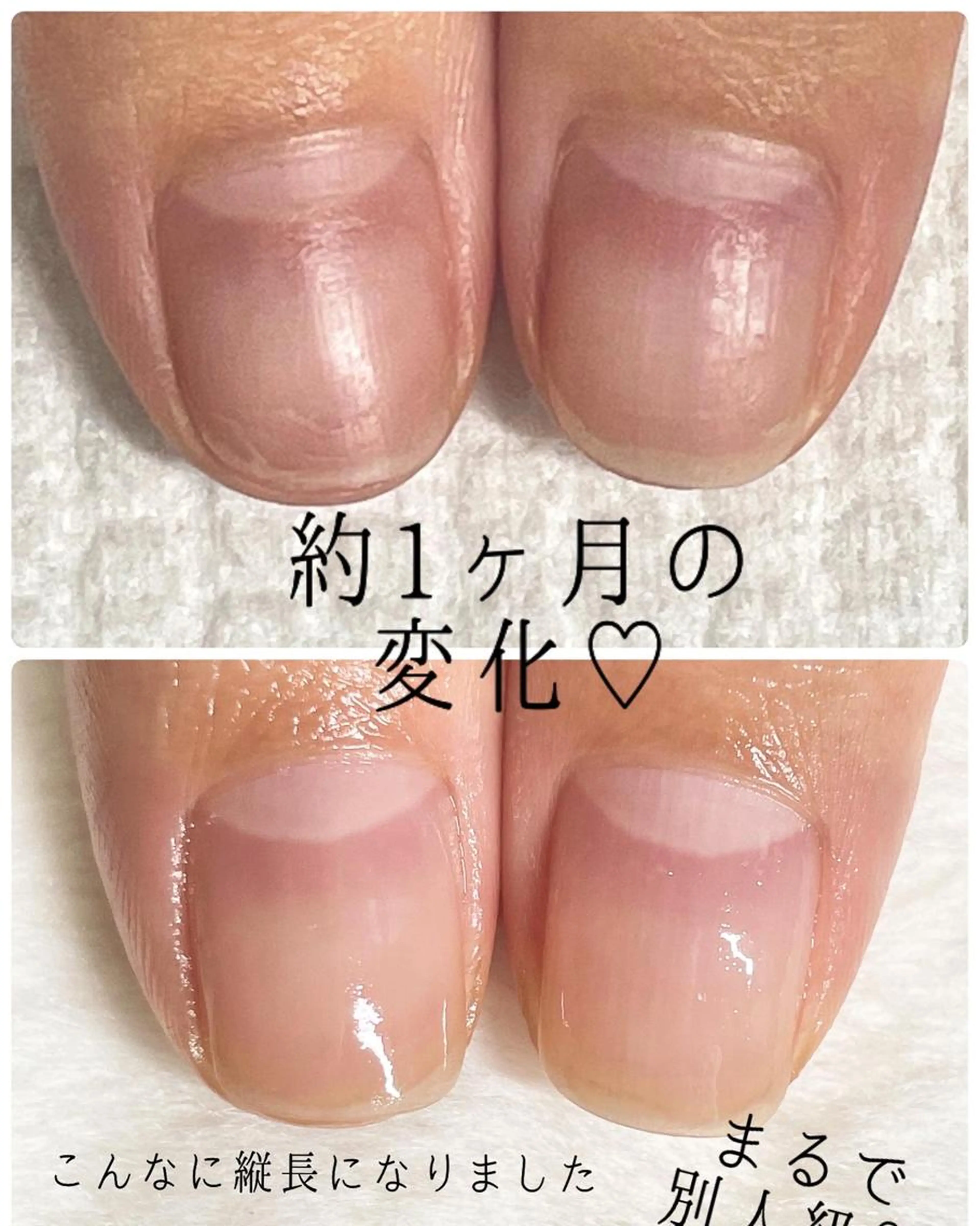 おすすめ‼️お試し美地爪ネイルケア💅ジェルで痛んだ爪にも1回体験🫧の写真