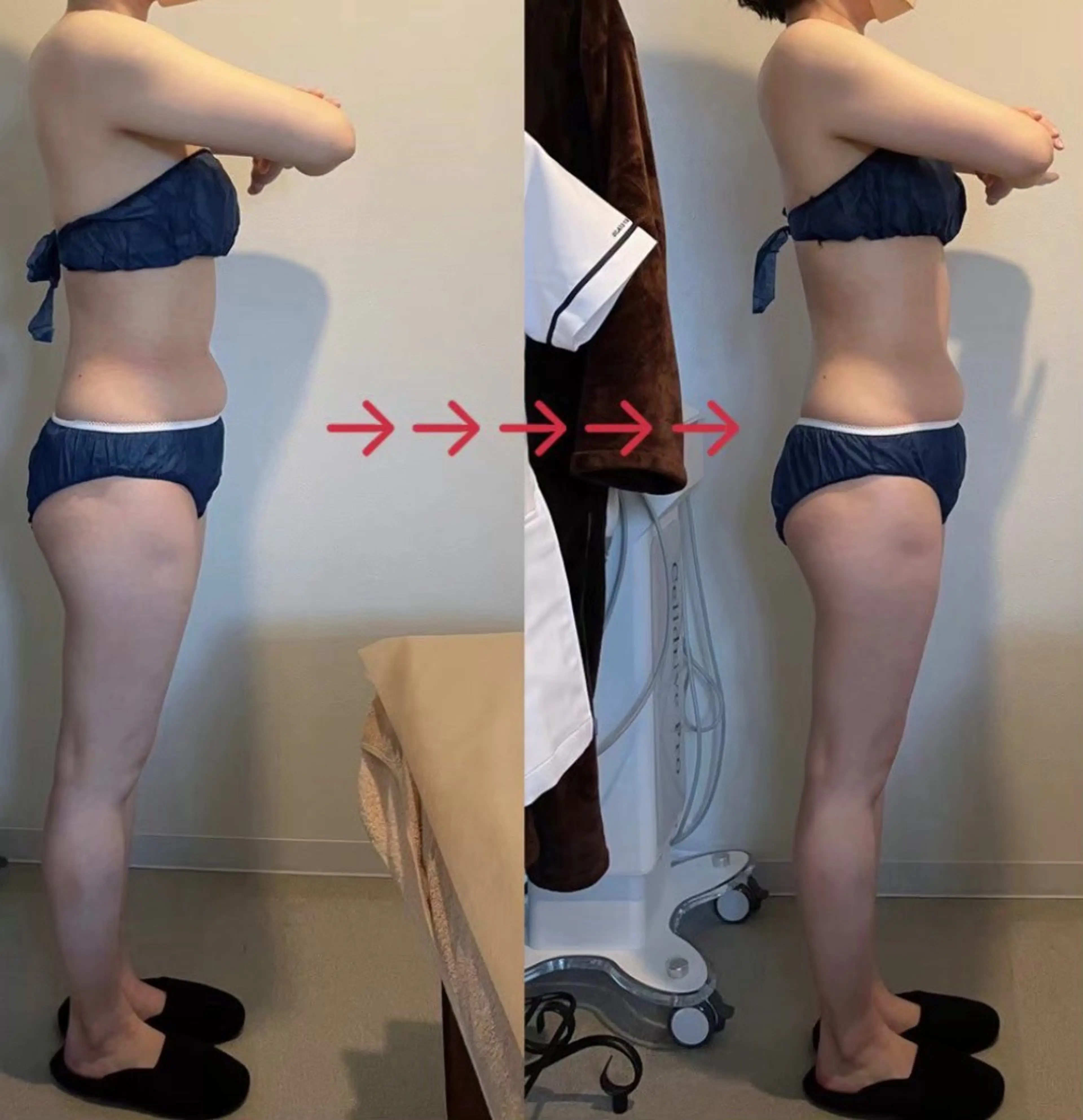 エステ 美容矯正&深層筋リンパ専門L・lien(エル・リアン)所属・痩身/小顔/矯正 🌟TOMOEのエステ・リラクイメージ