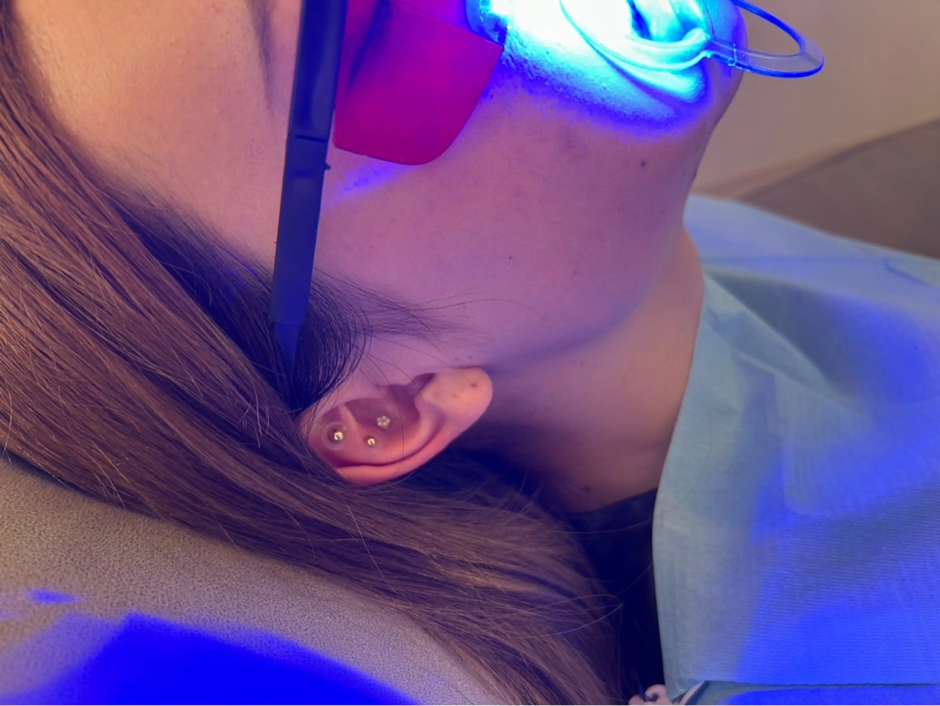 東区香椎歯のセルフホ ワイトニングGLOWのその他イメージ