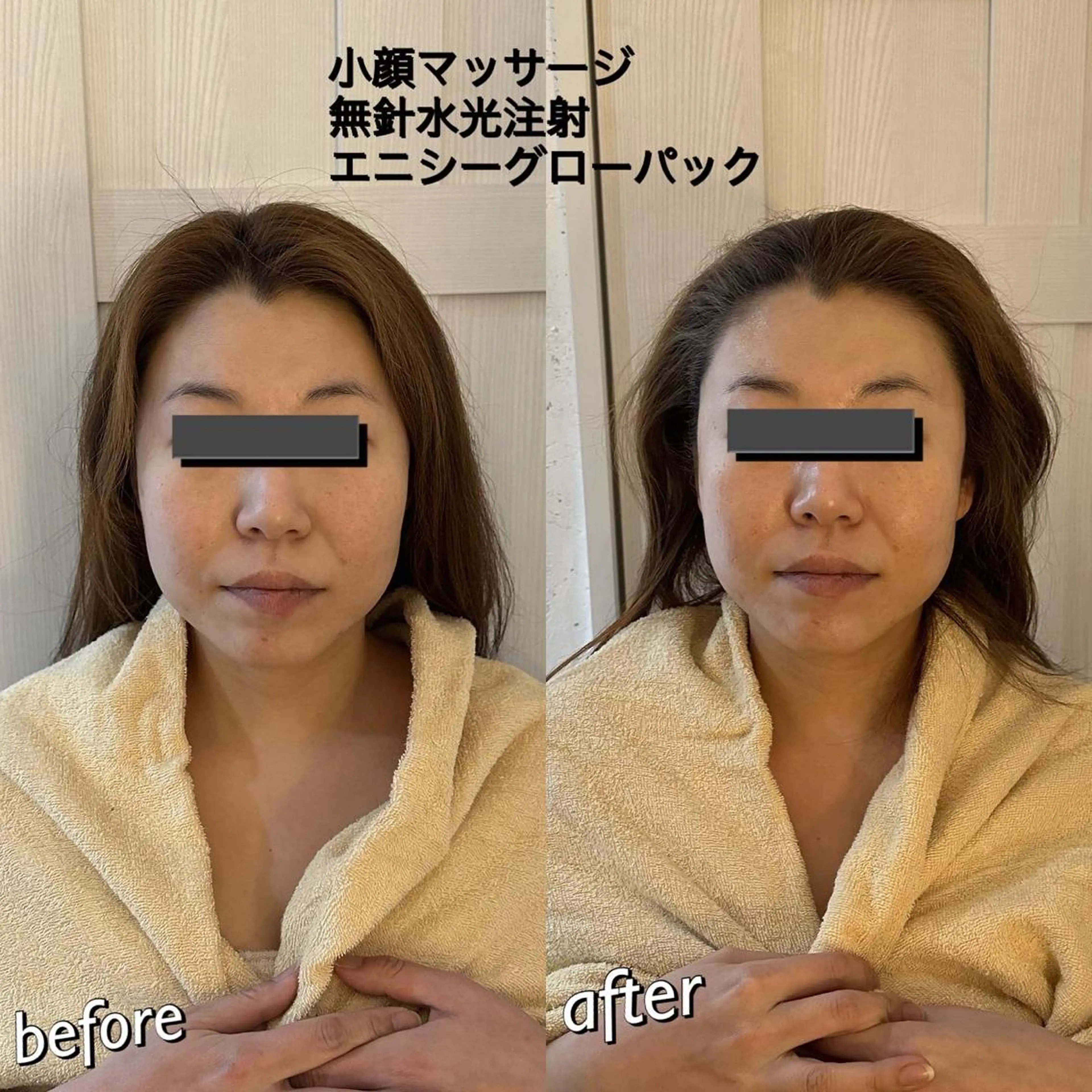 うなじ脱毛/美肌脱毛 LABELのエステ・リラクイメージ