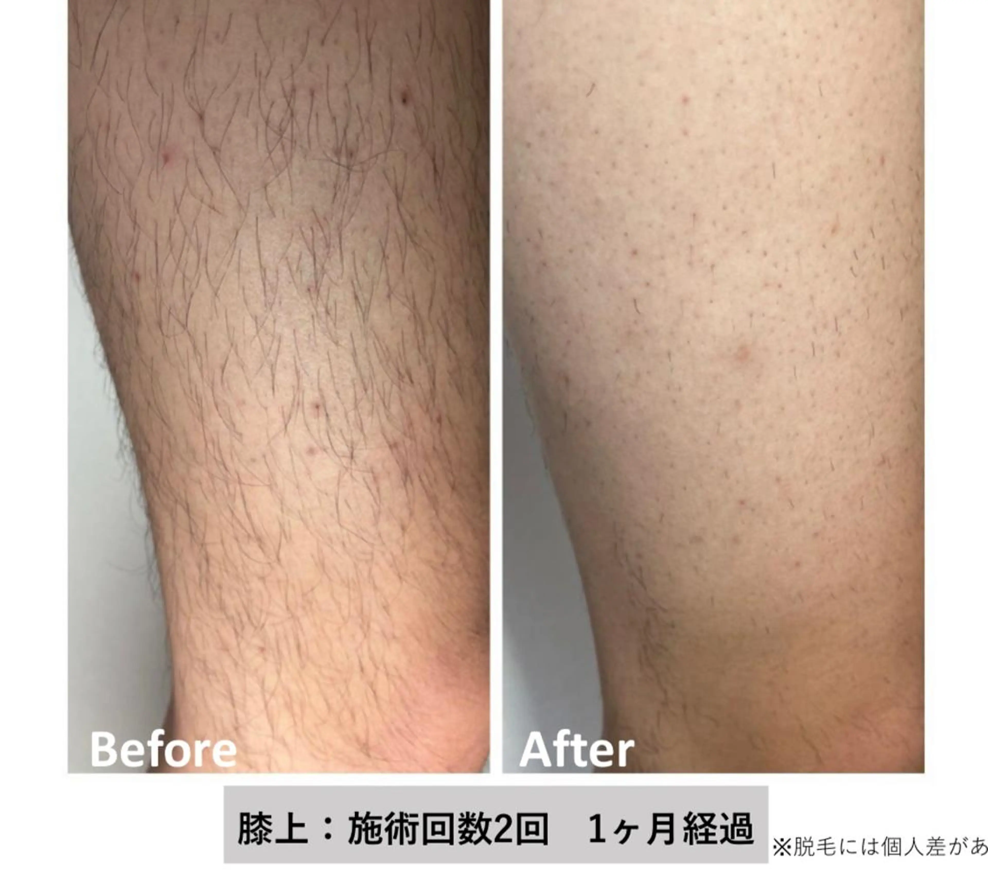 メンズ キッズ esperanza エスペランサのその他イメージ