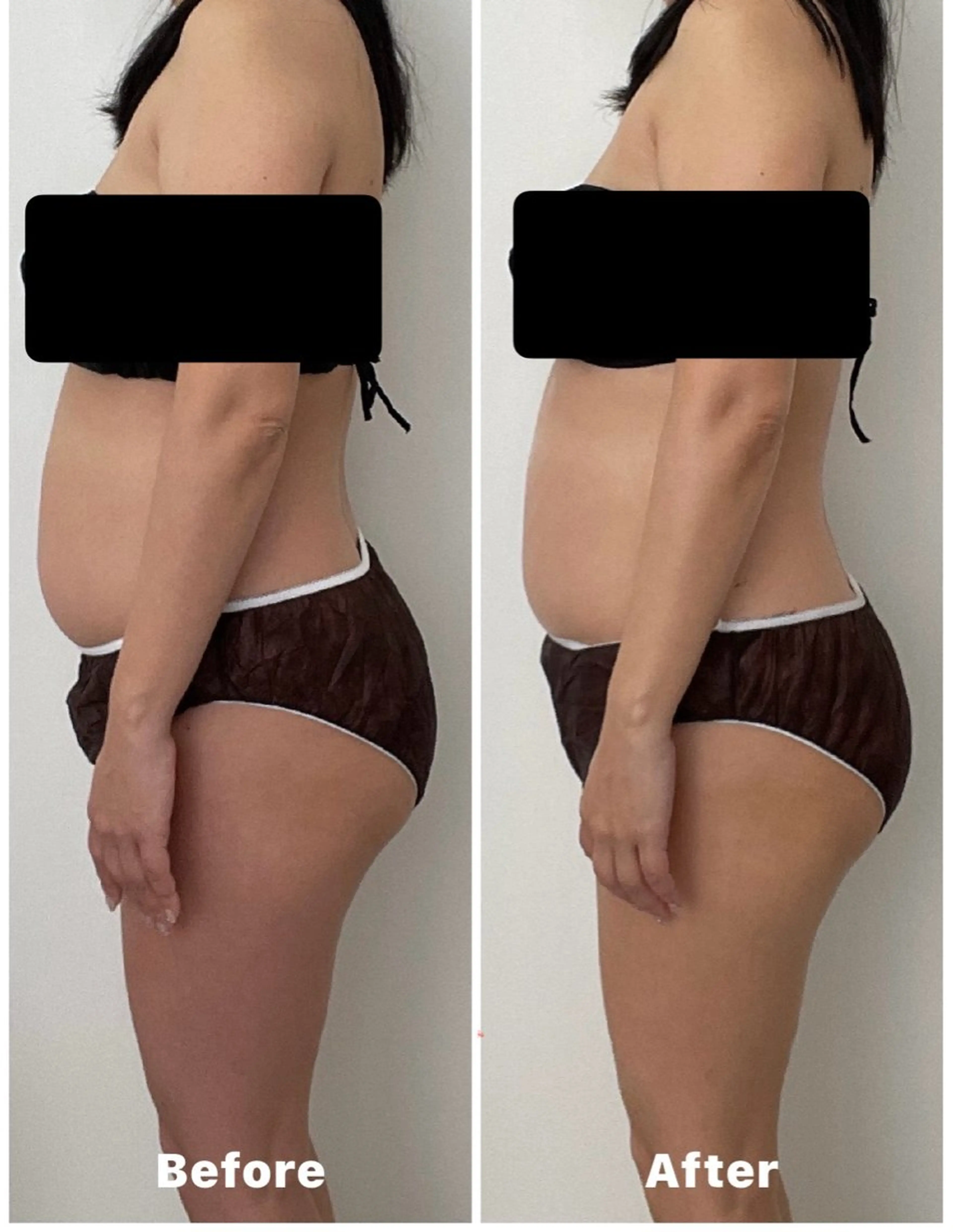 エステ リラク 心と体が整う腸活 サロン ラクシュミーのエステ・リラクイメージ