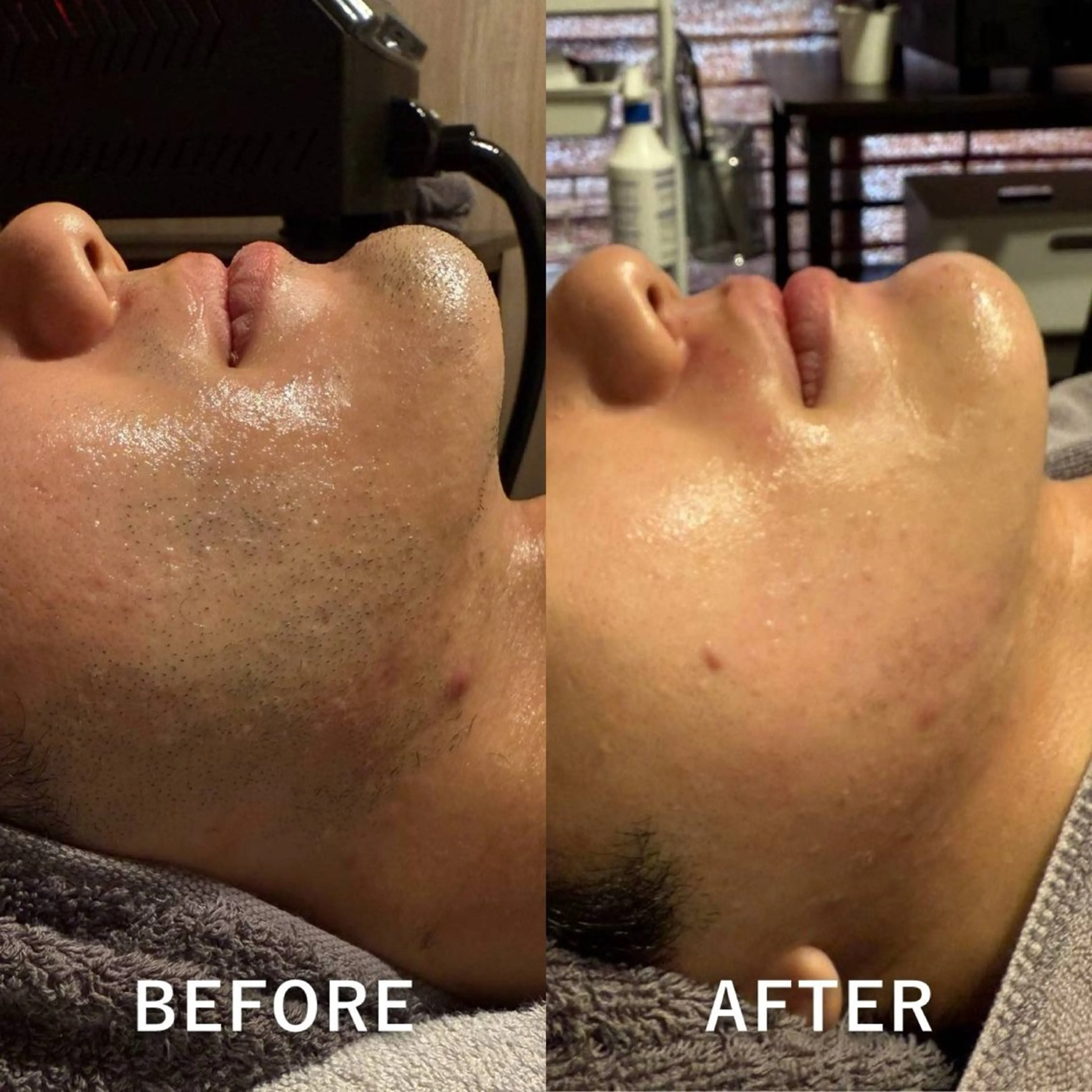 メンズ 脱毛 Aurora所属・目元美×脱毛 Clé-yunaのエステ・リラクイメージ