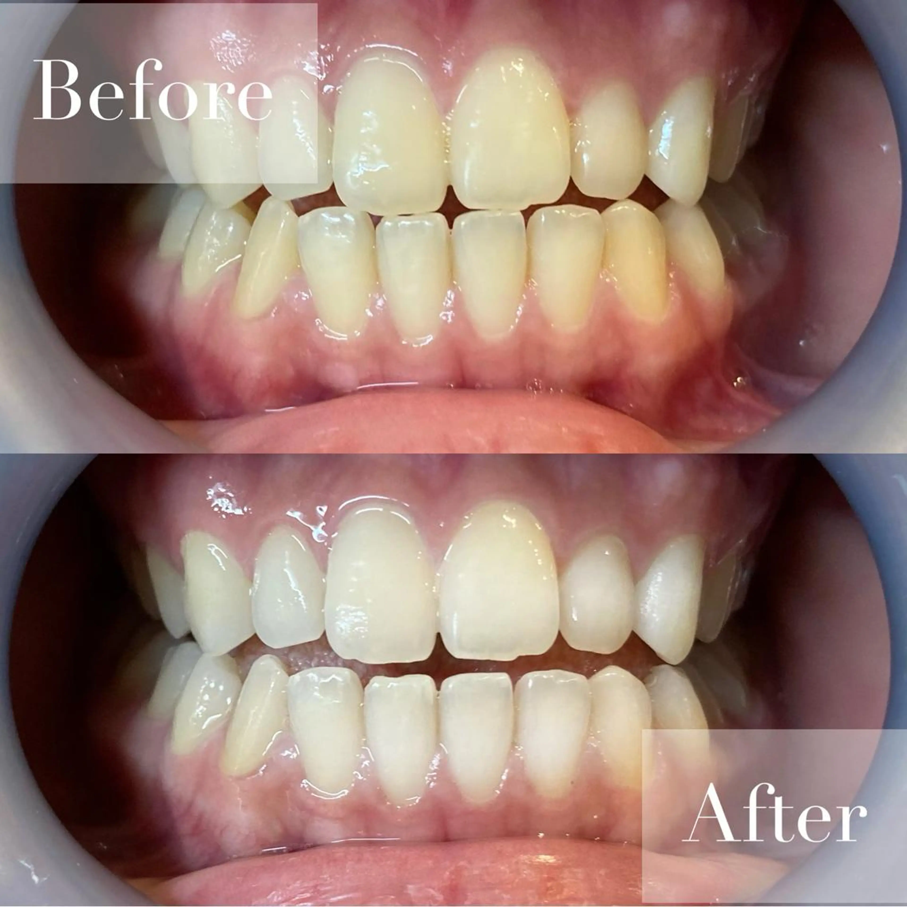 エステ リラク LBSホワイトニング 新宿店💎店長のエステ・リラクイメージ