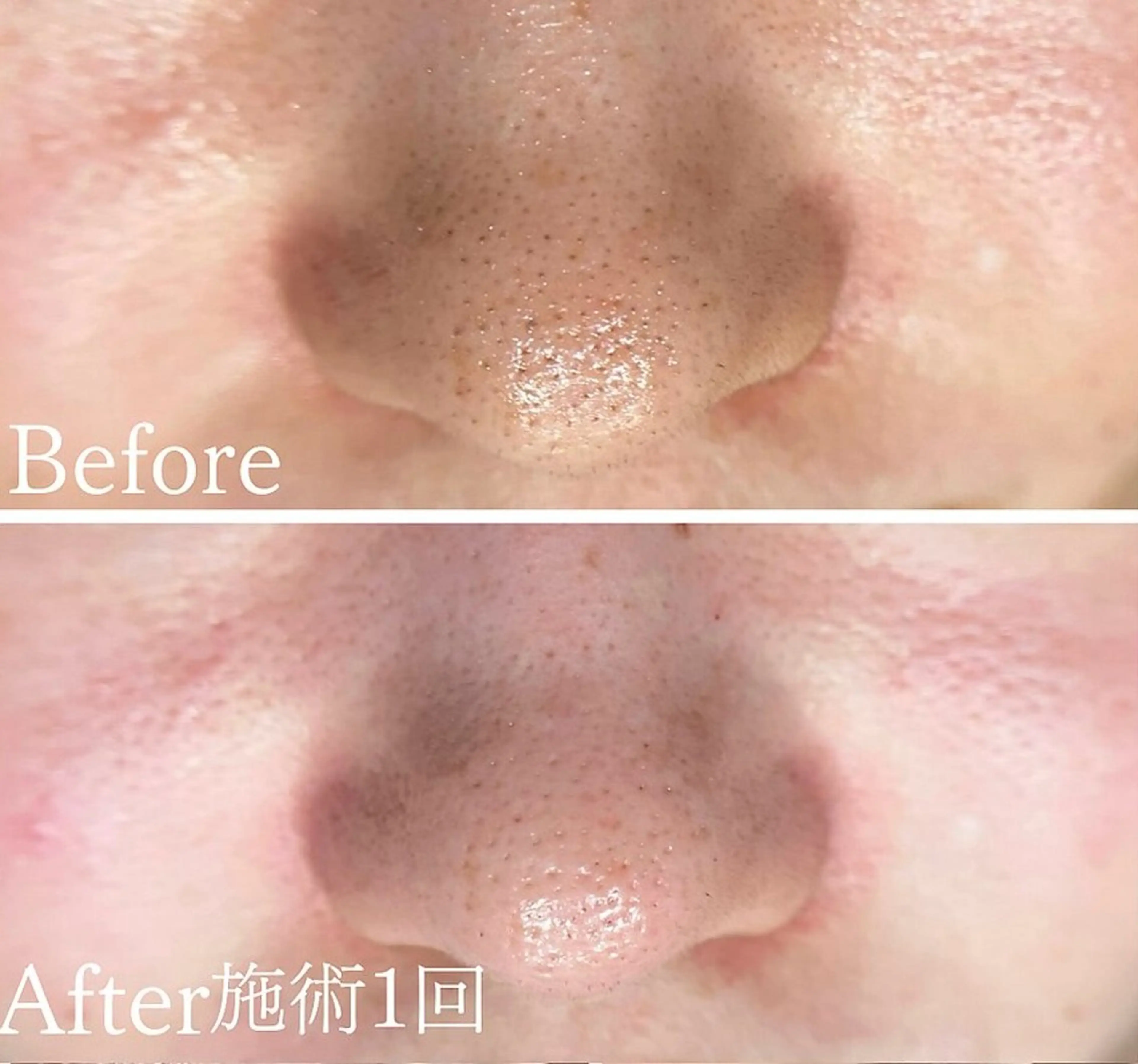 アンド ミルルのエステ・リラクイメージ