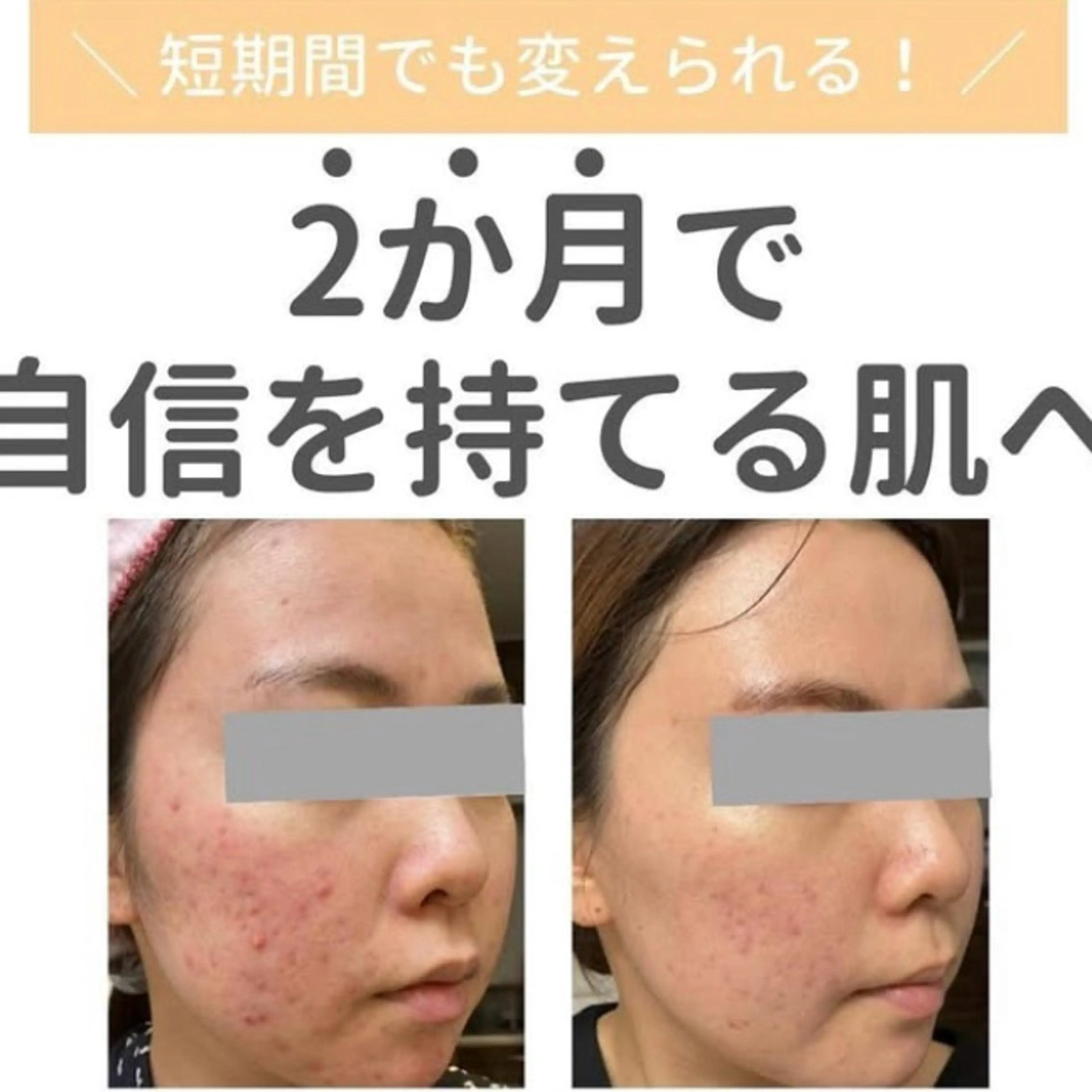 堀江リンパマッサージ 肩こり/リンパ/小顔のエステ・リラクイメージ