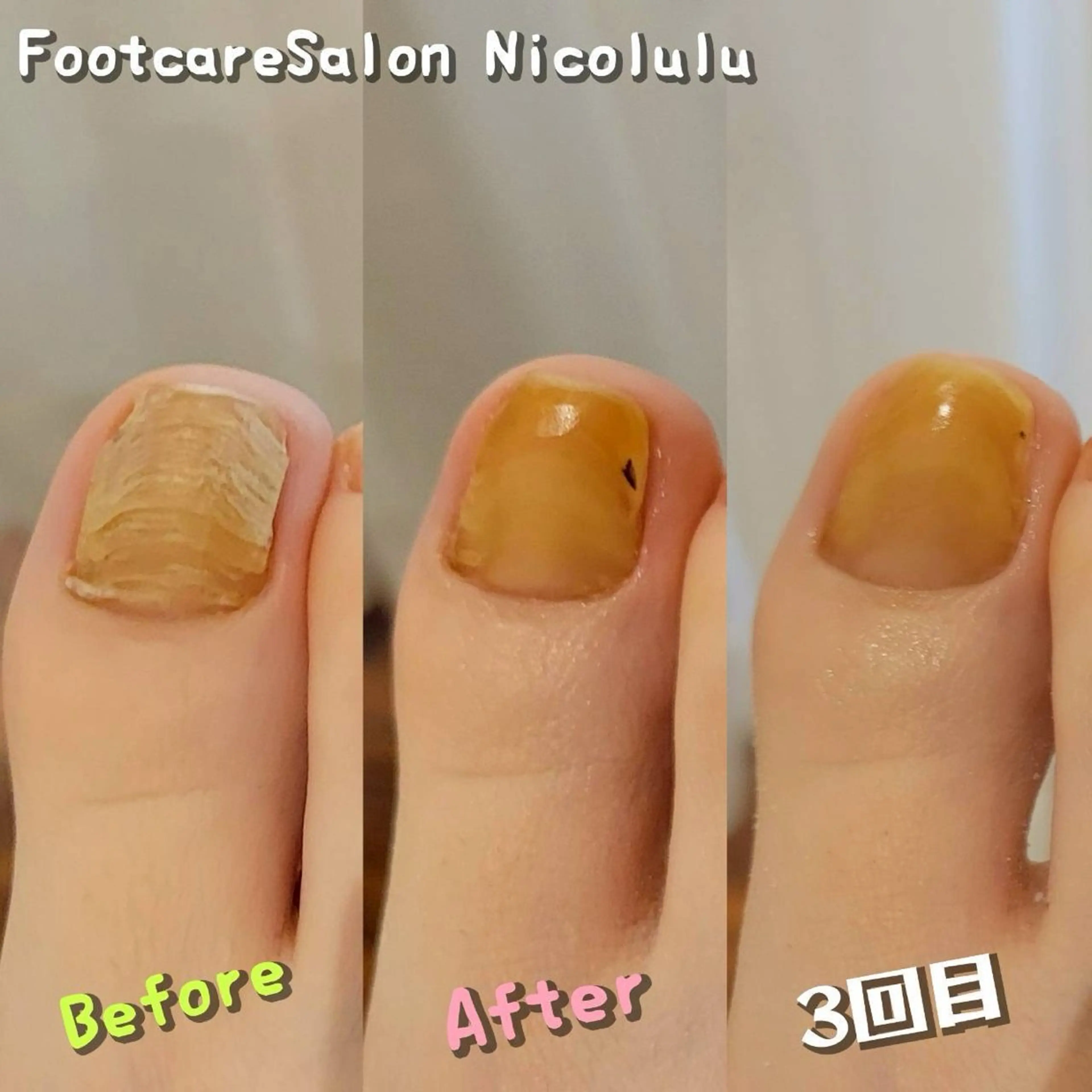 メンズ リラク 足トラブル専門 ニコルル金沢のエステ・リラクイメージ