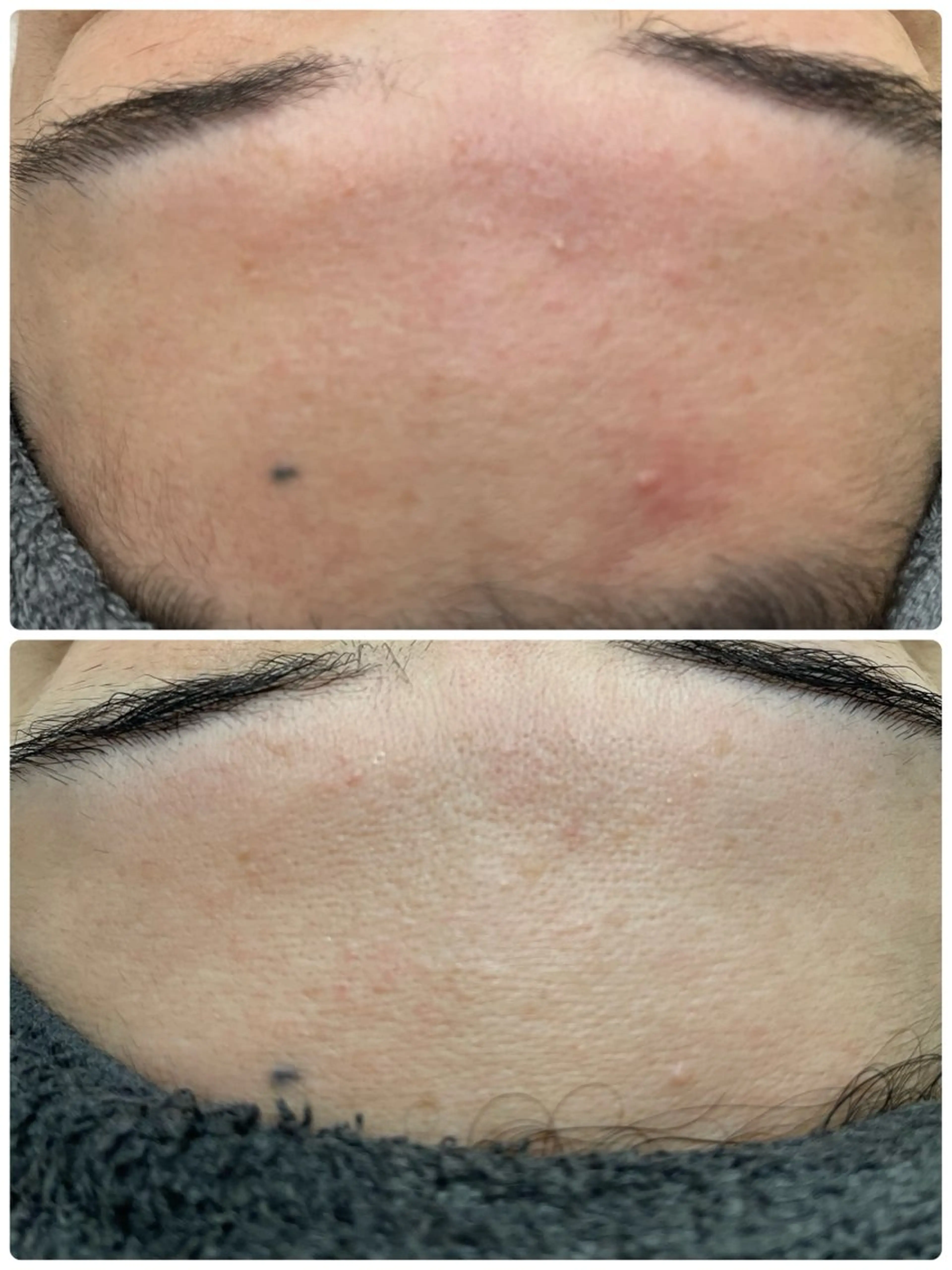 NHerb【エヌハーブ】所属・横田 汐里のネイルデザイン