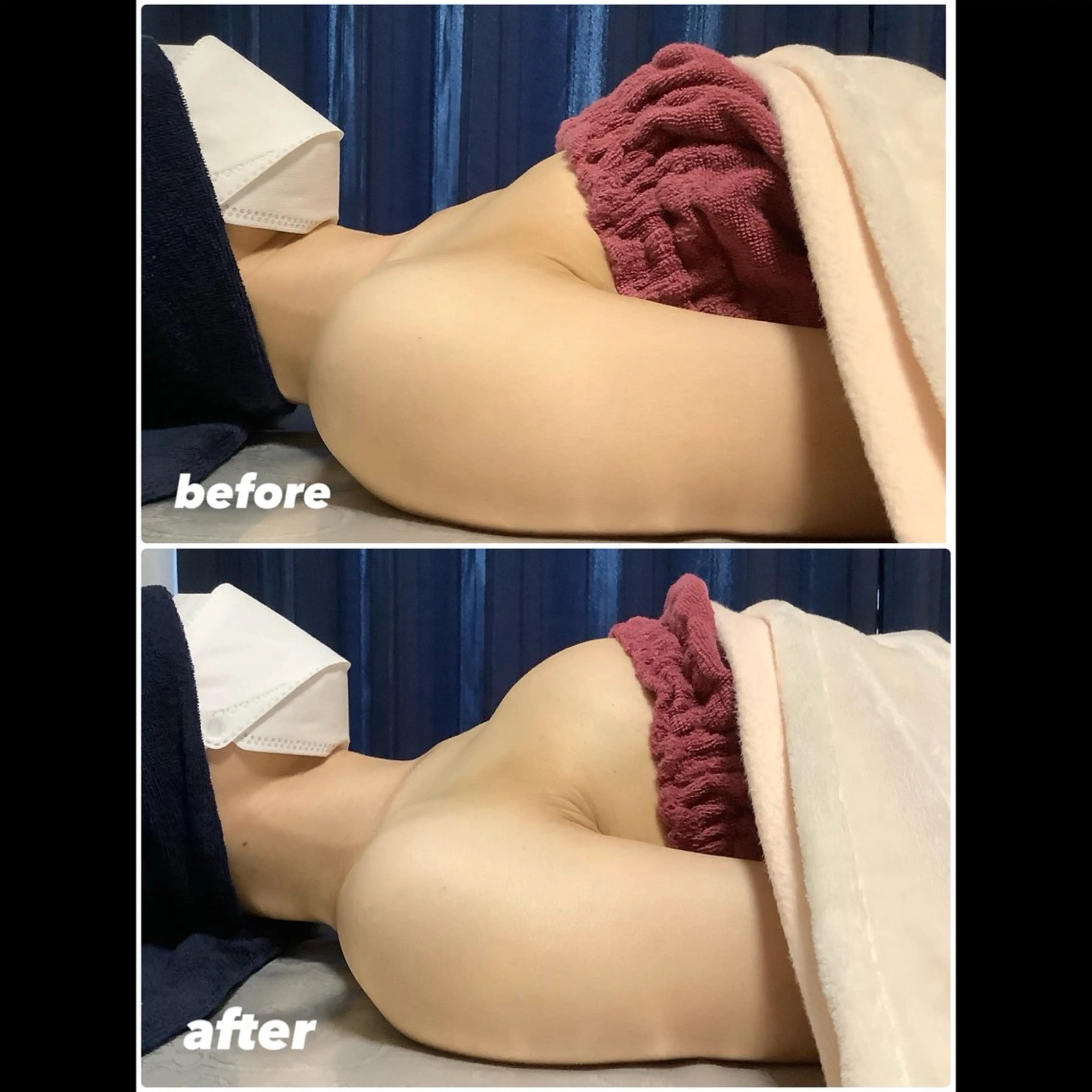 小胸にはさようなら…憧れのふわふわバストへの写真