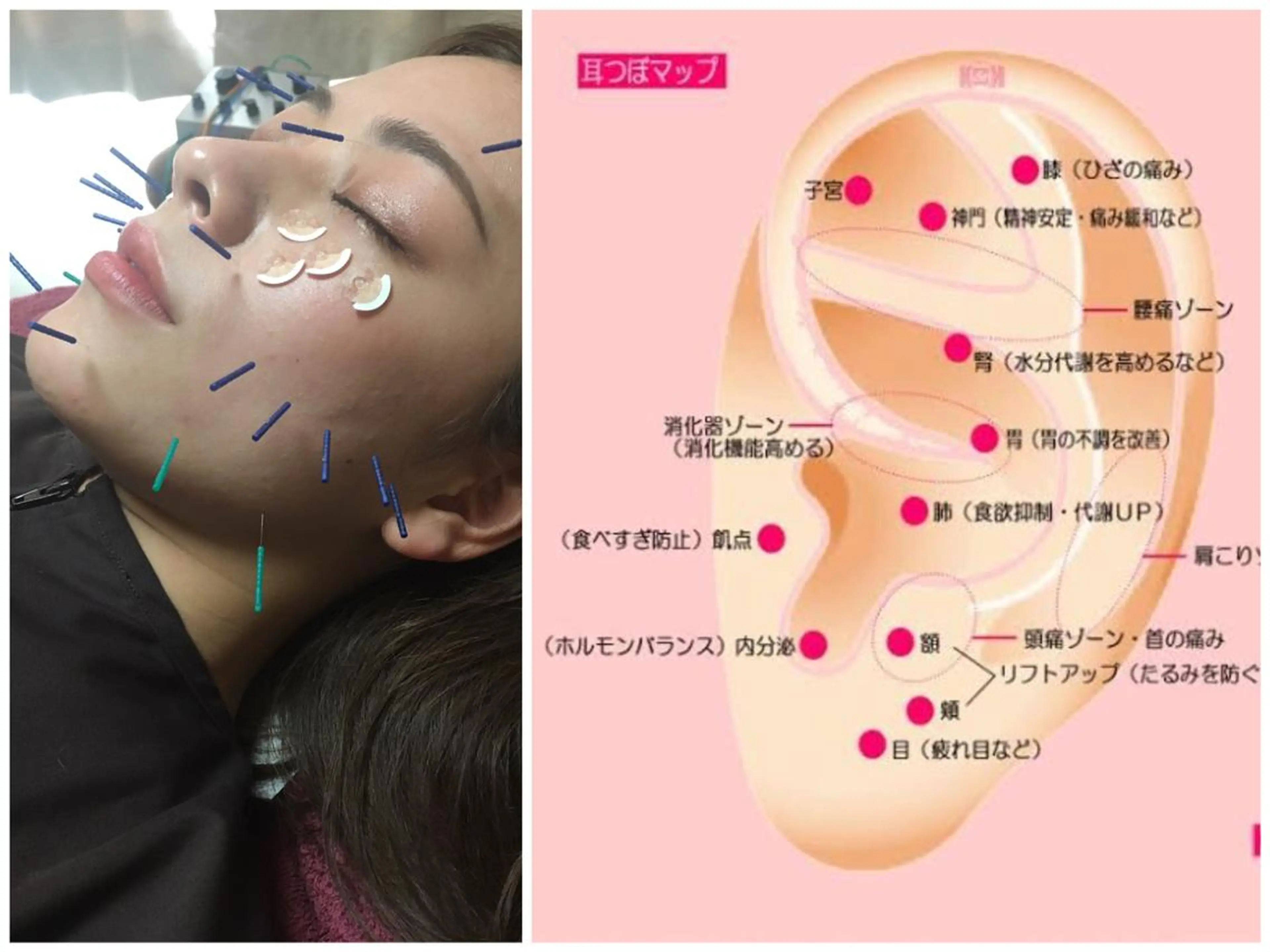 美容鍼灸女性専用 りんご鍼灸治療院のその他イメージ