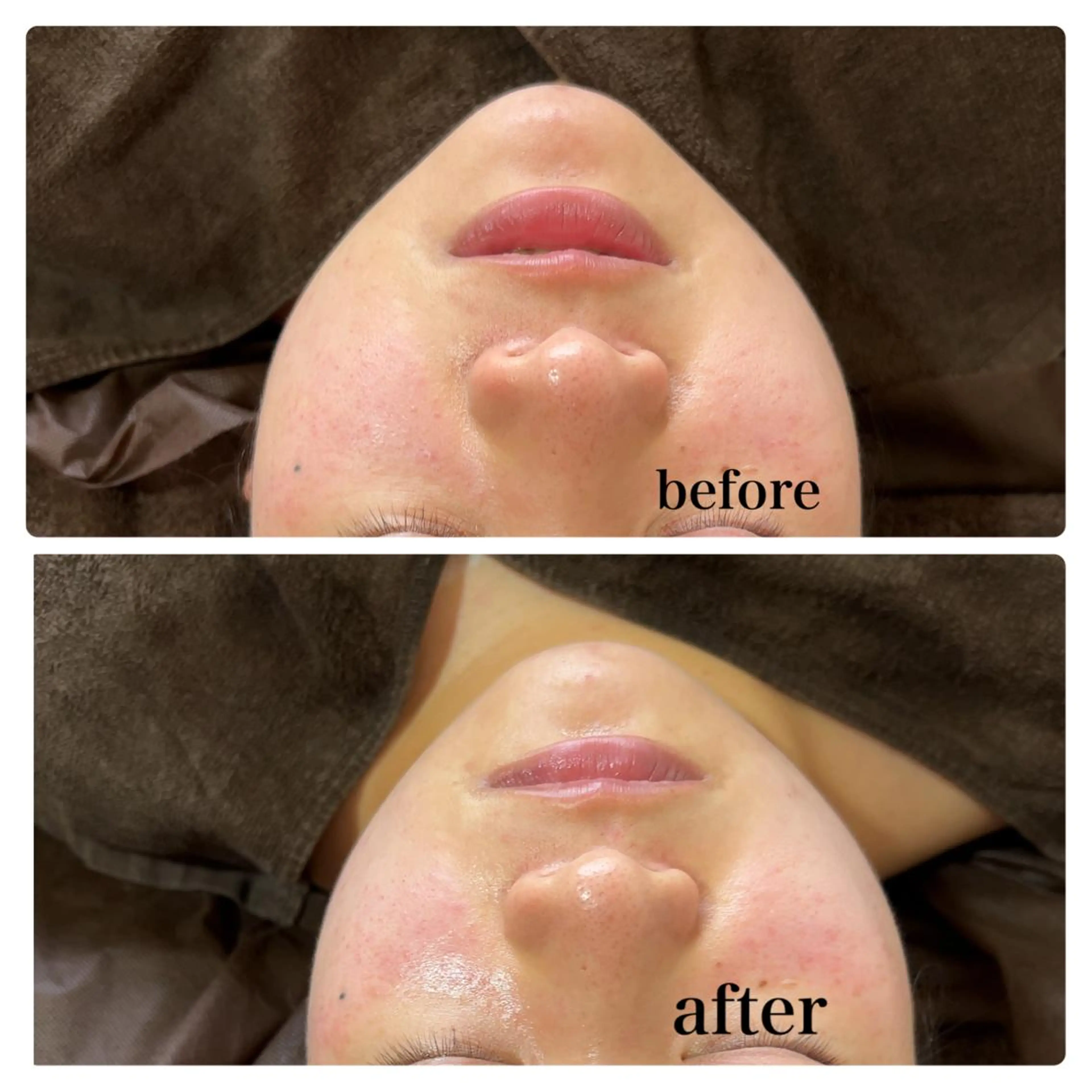 エステ リラク espoir エスポワールのエステ・リラクイメージ