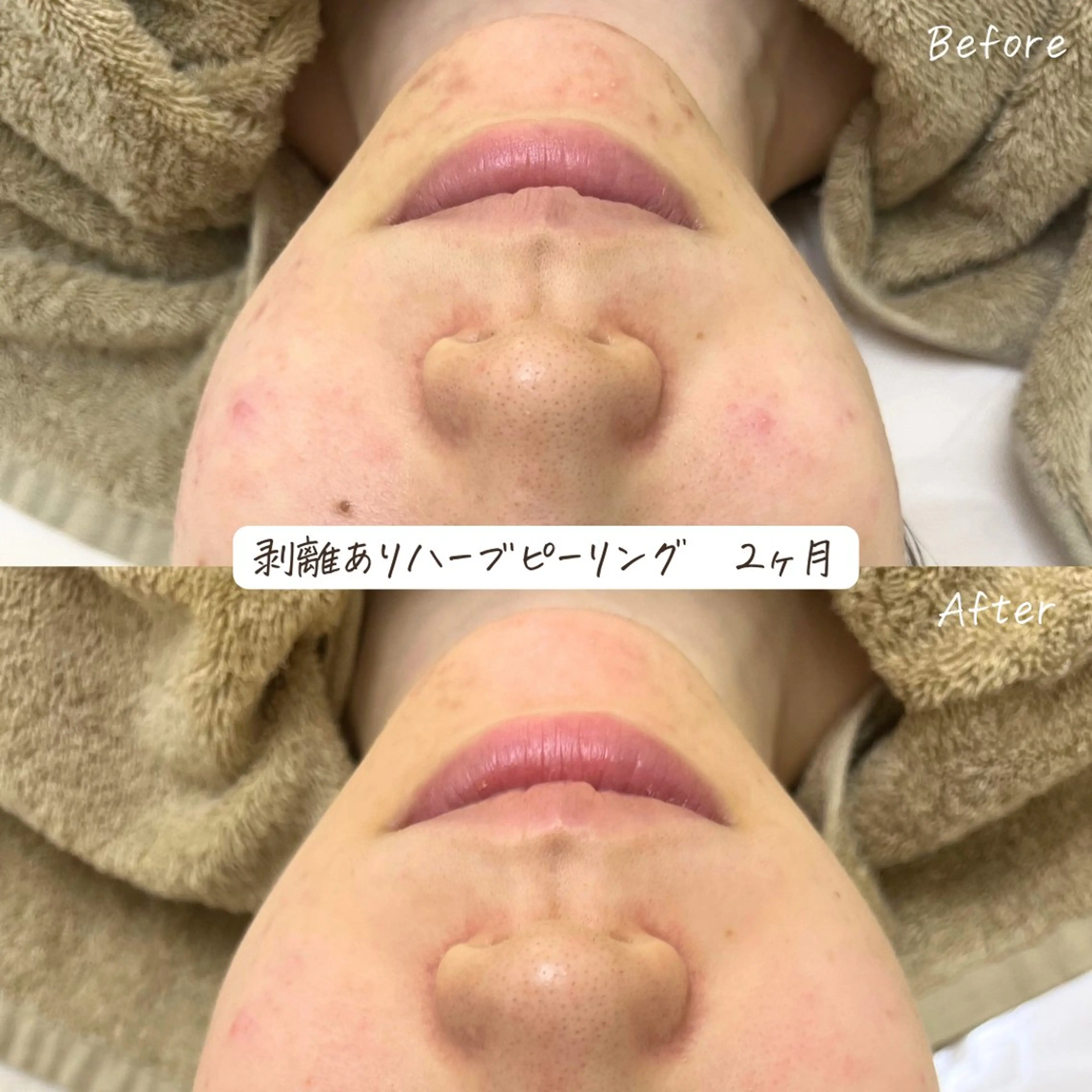 肌質改善サロン renew/ｳｴｷのエステ・リラクイメージ