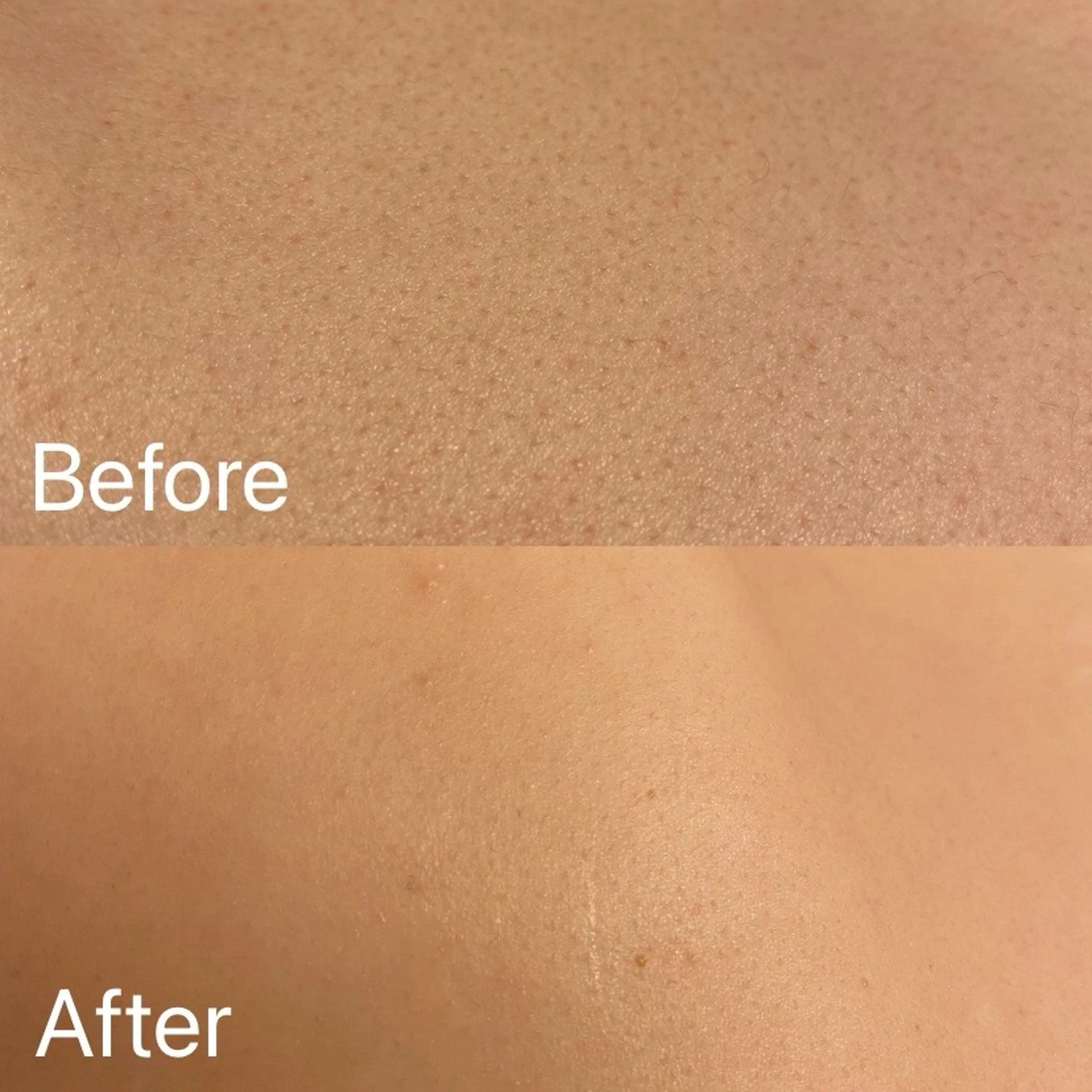 脱毛 Dione自由が丘 山下有香子のエステ・リラクイメージ