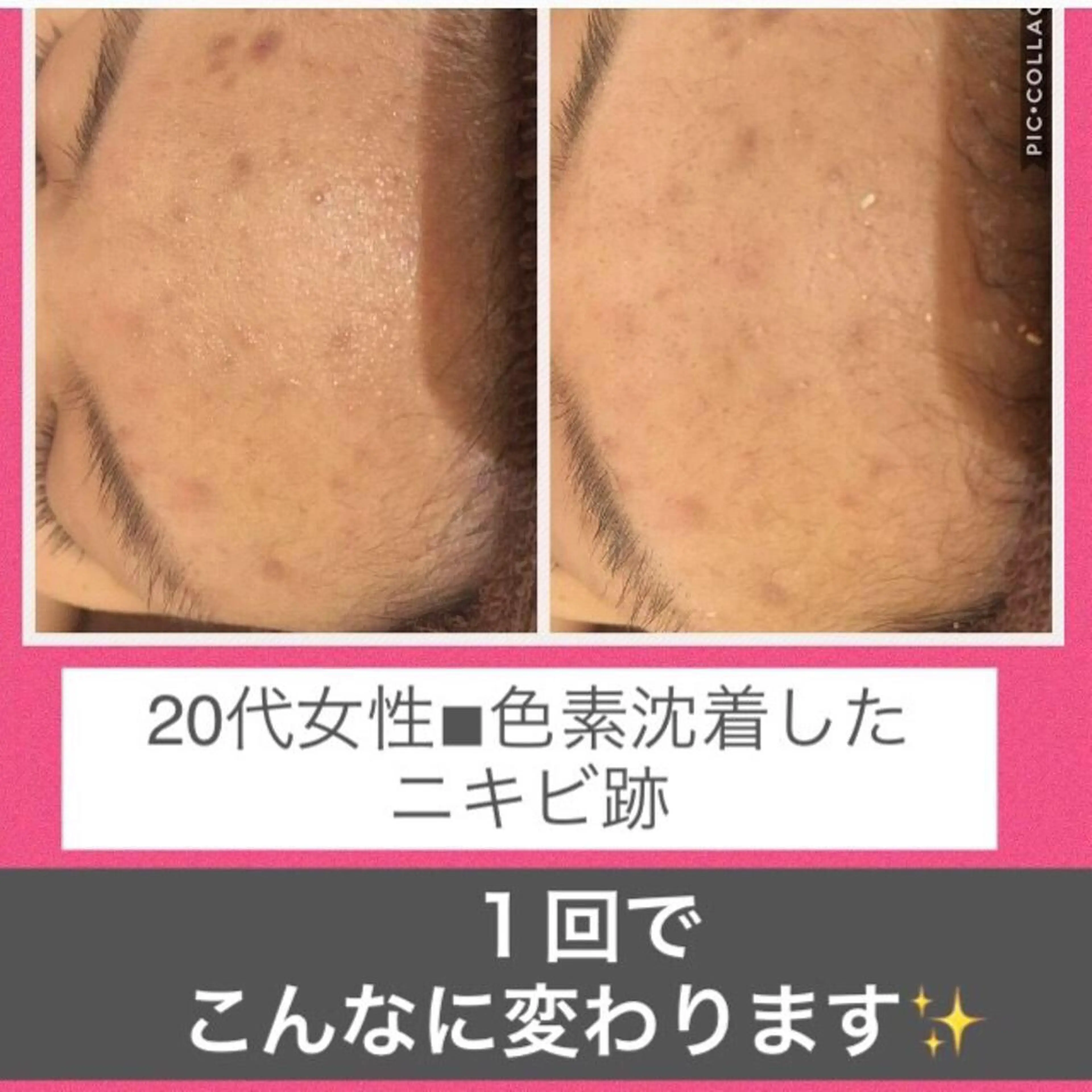 ショート カラー パーマ ヘアアレンジ メンズ キッズ ネイル マツエク・マツパ ニキビ・肌質改善専門 ♡人生が変わるサロンのエステ・リラクイメージ