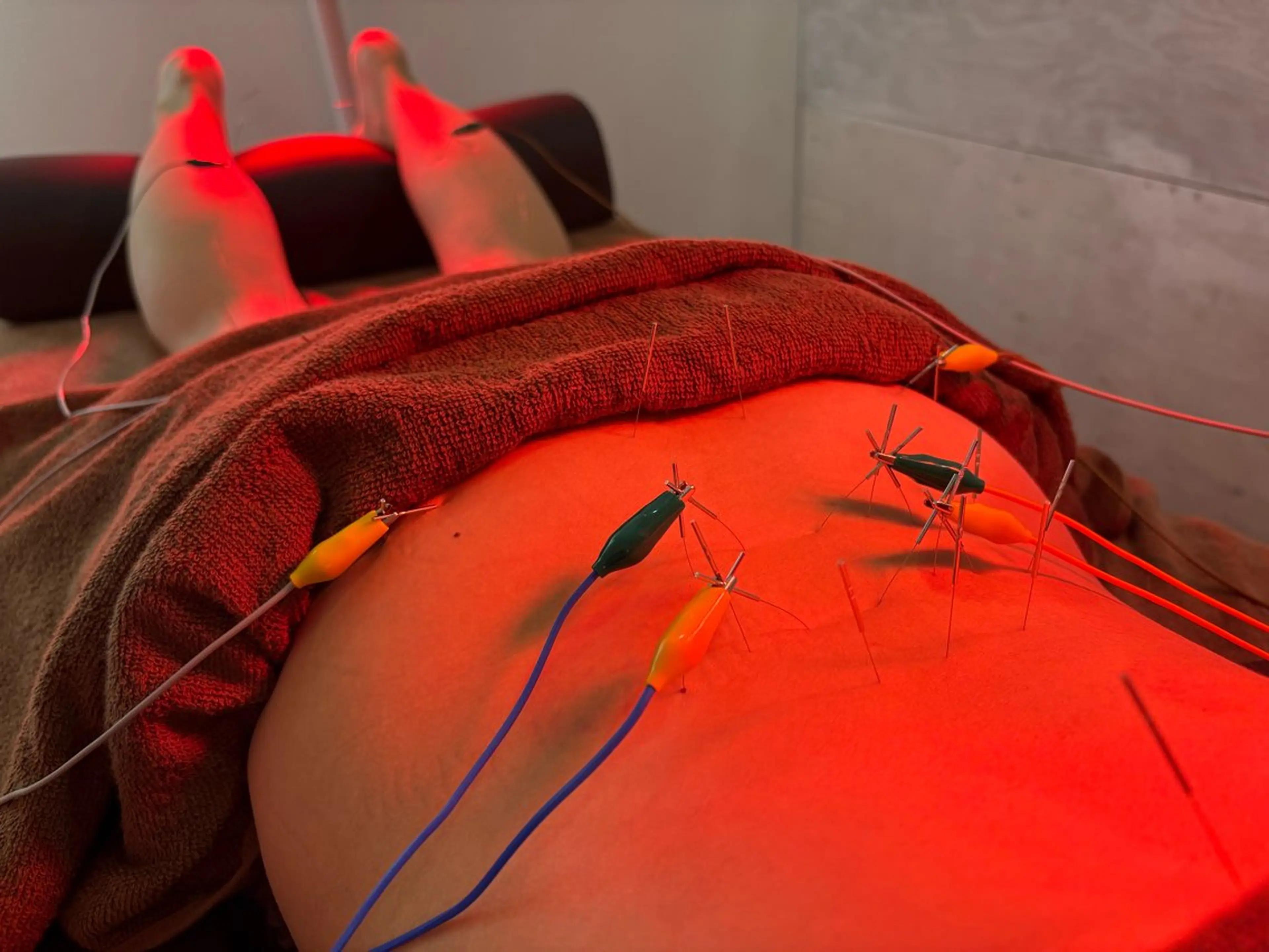 Spring鍼灸院 ✨首肩こり、腰痛に！のその他イメージ