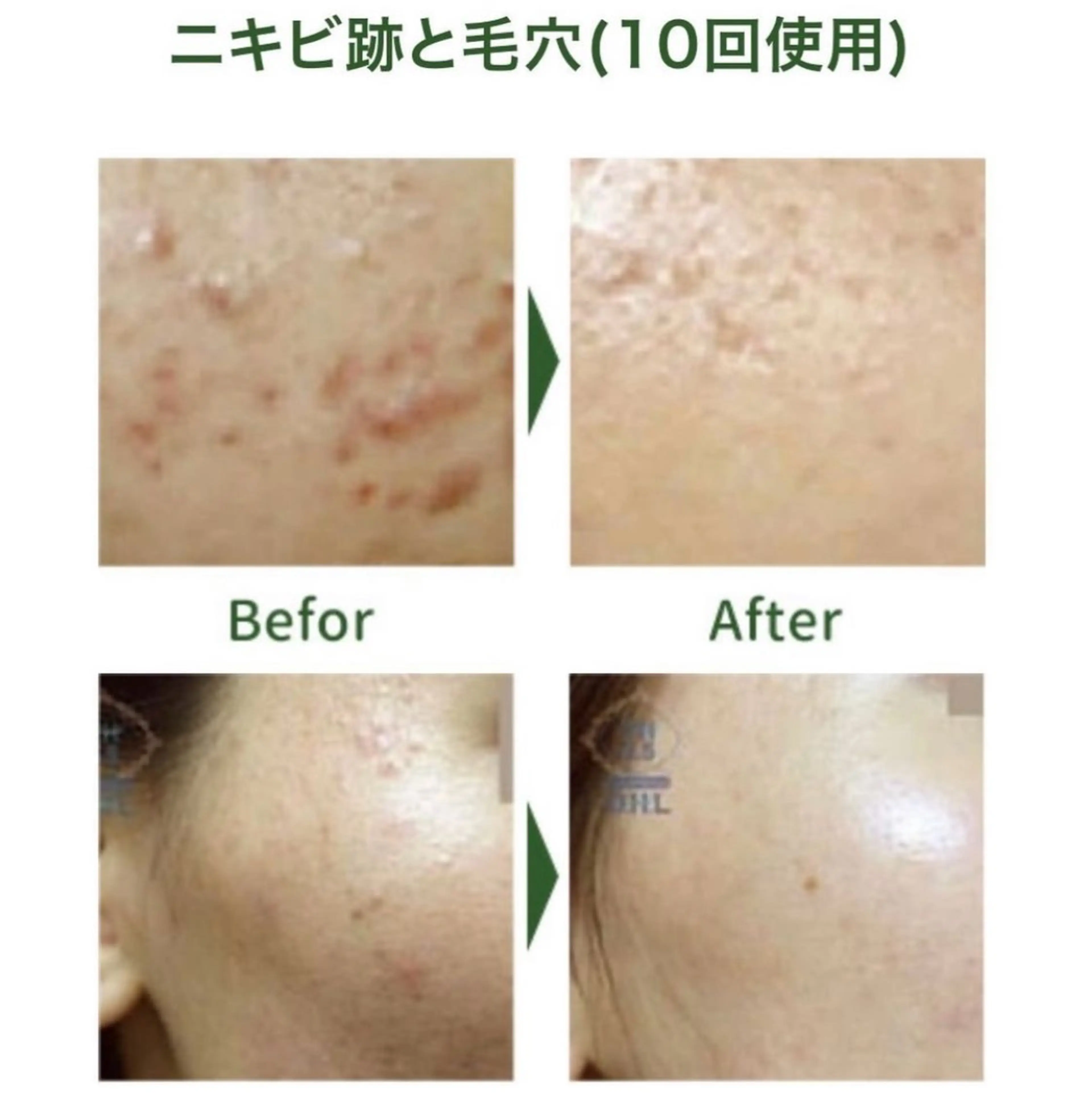 上坂 祐以のエステ・リラクイメージ