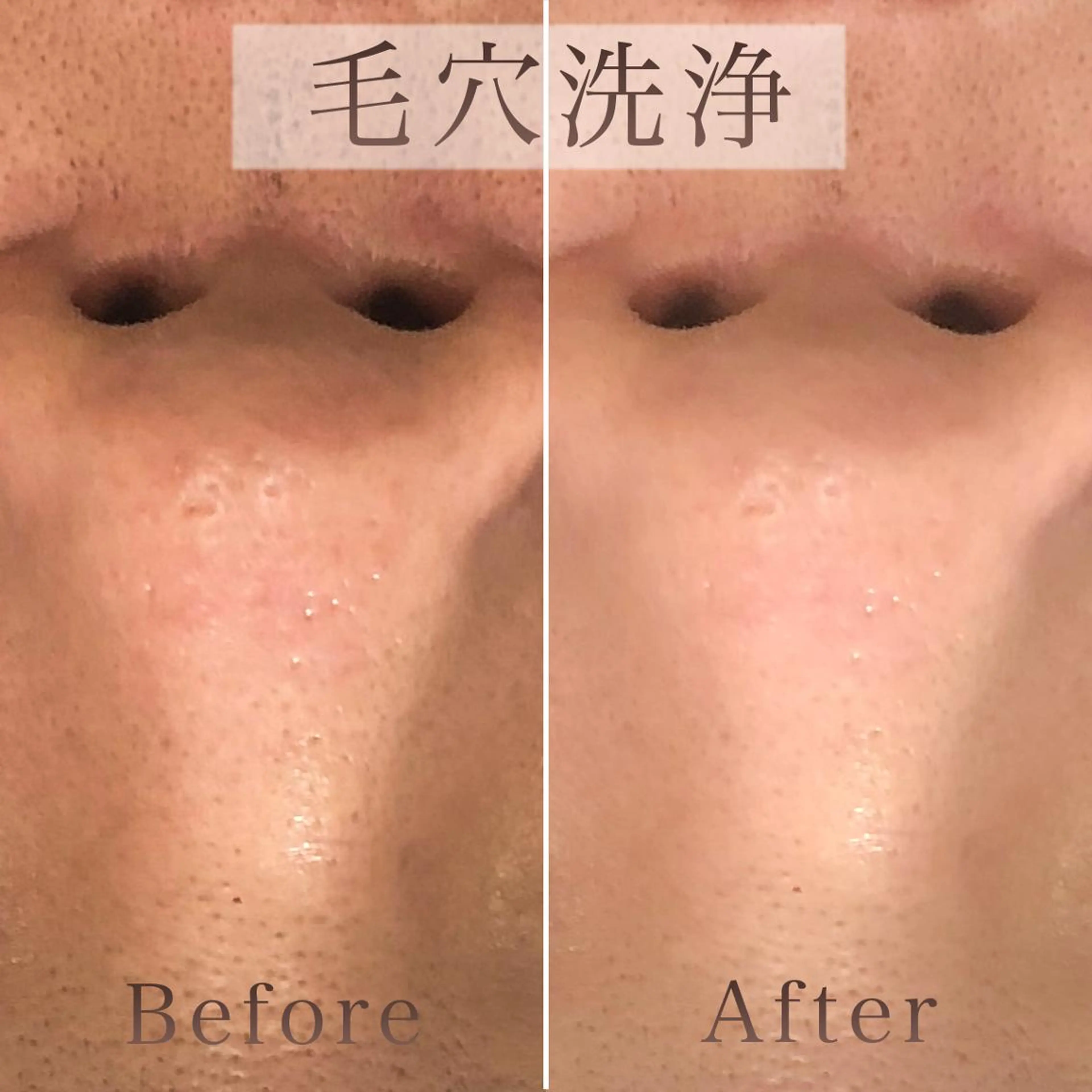 エステ リラク 【毛穴洗浄・小顔】 セラピスト　和田紋子のエステ・リラクイメージ