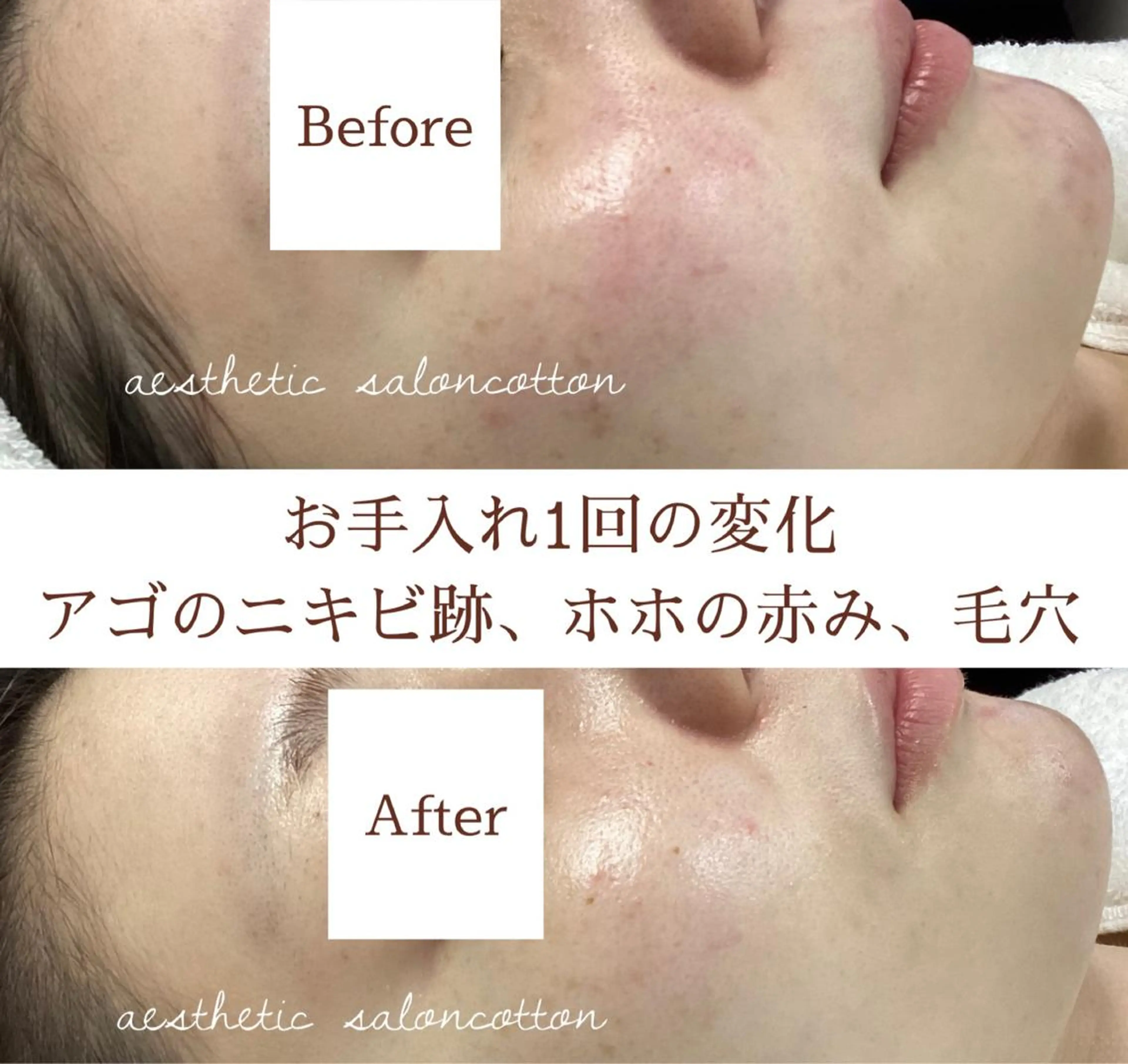 エステ 都度払い 肌質改善専門サロンのエステ・リラクイメージ