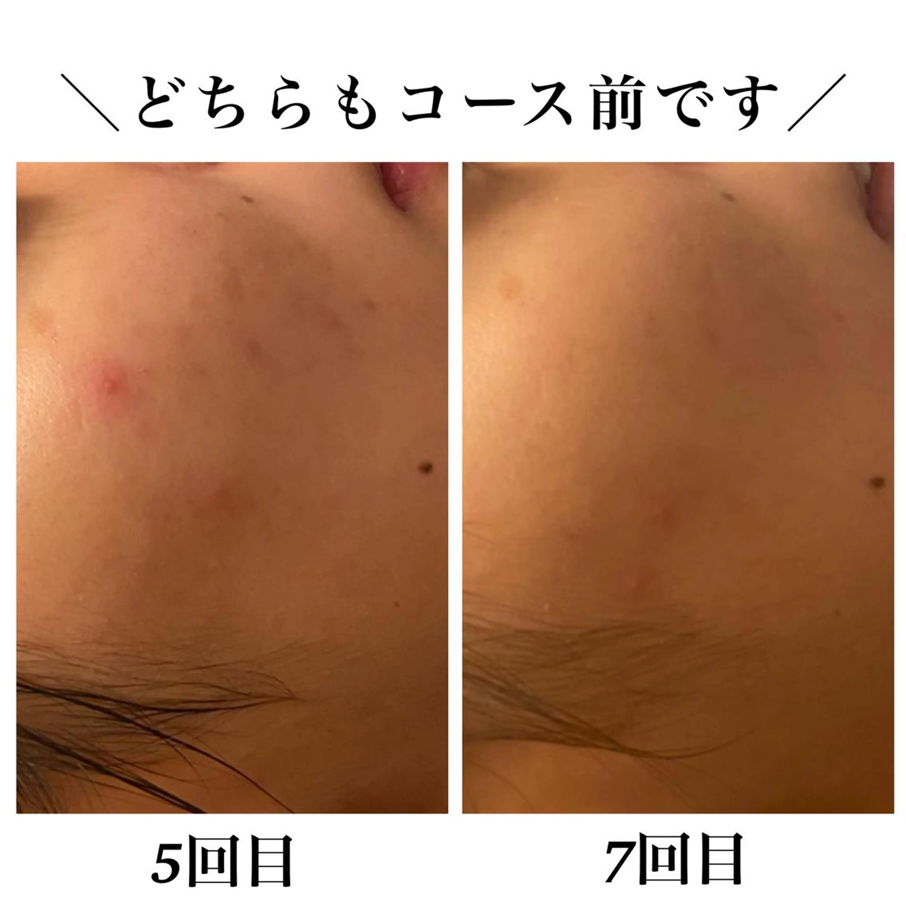 Bellesthe (ベルエステ)のエステ・リラクイメージ