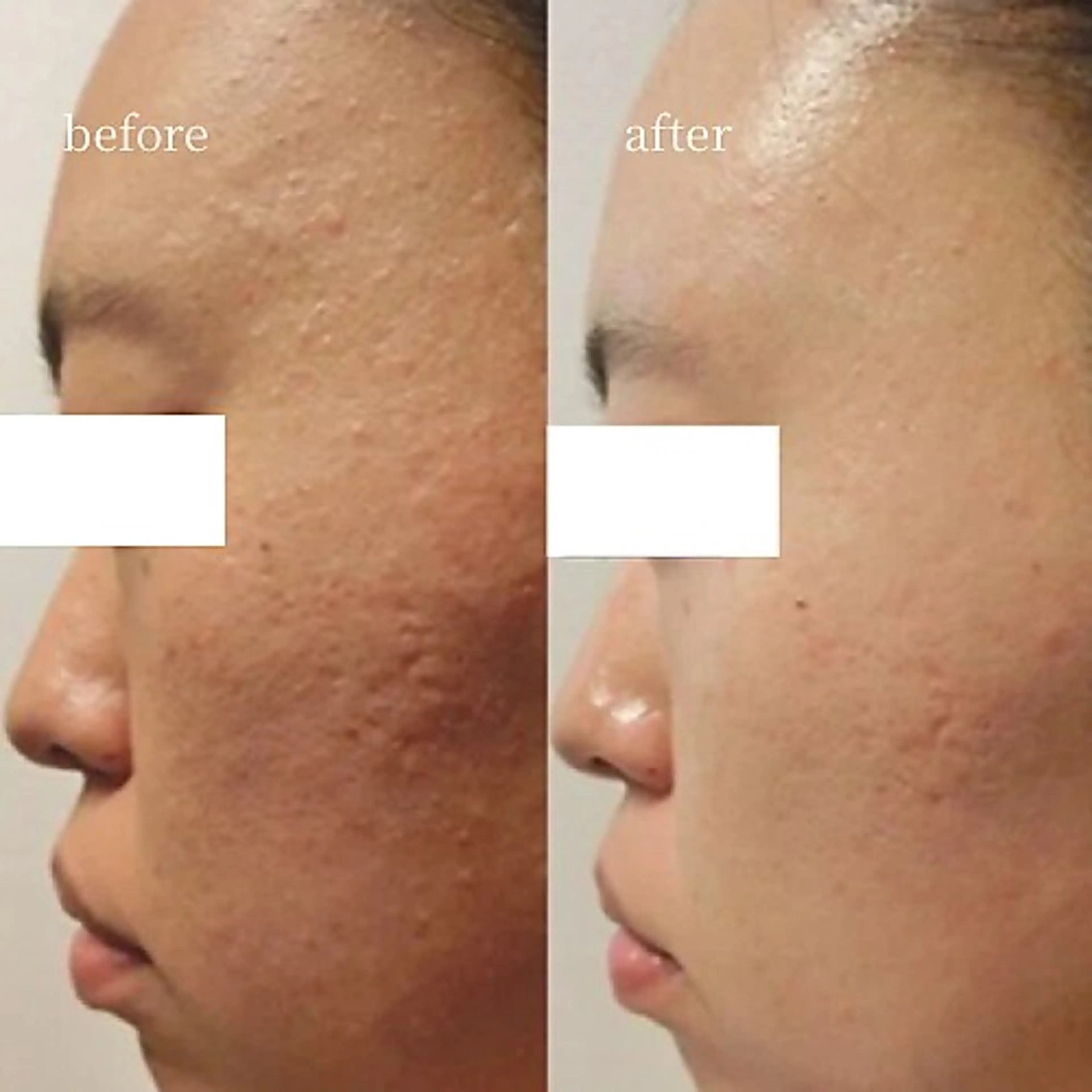 エステ 韓国肌管理・肌質改善 EARNEST心斎橋のエステ・リラクイメージ