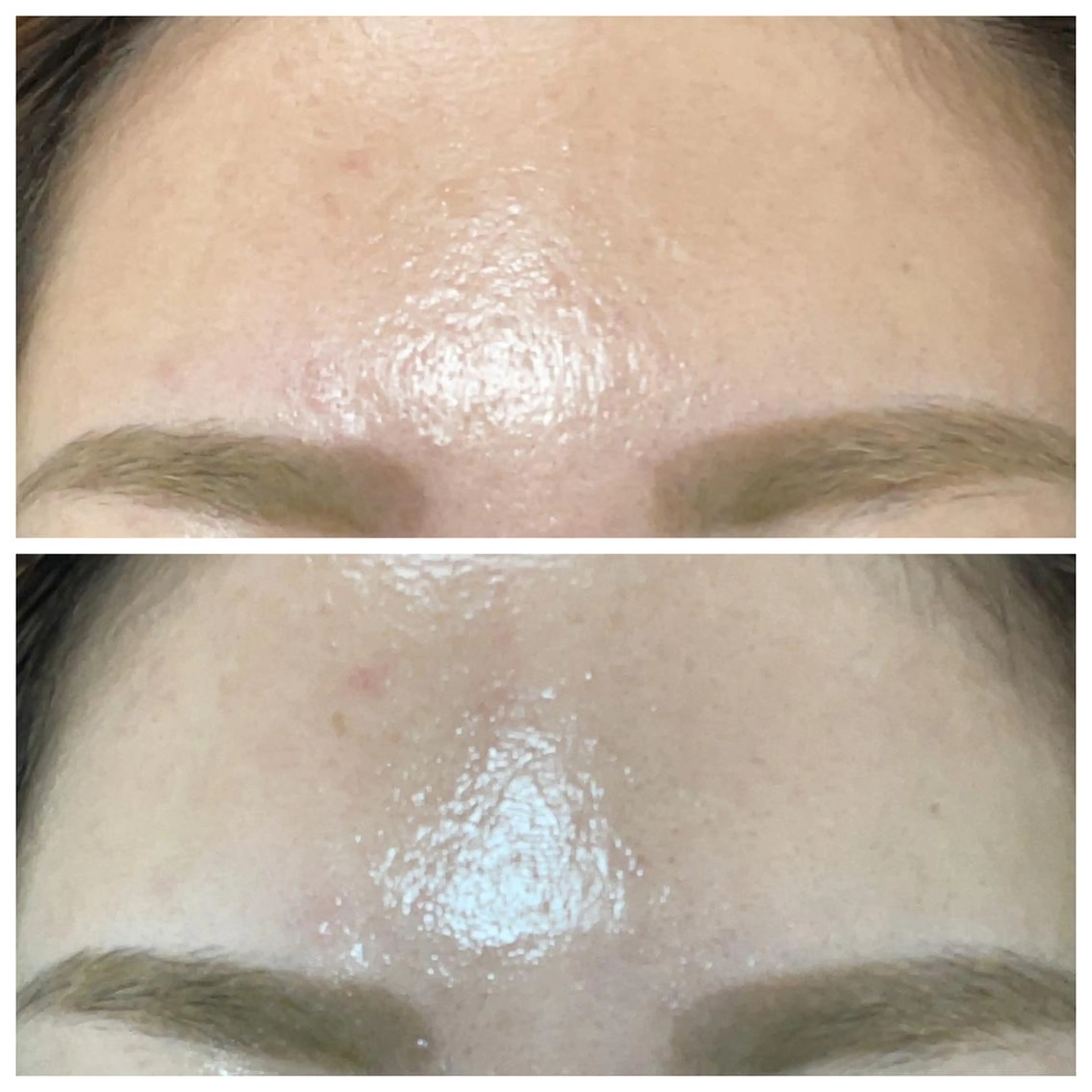 肌質改善サロン facialmoonのエステ・リラクイメージ