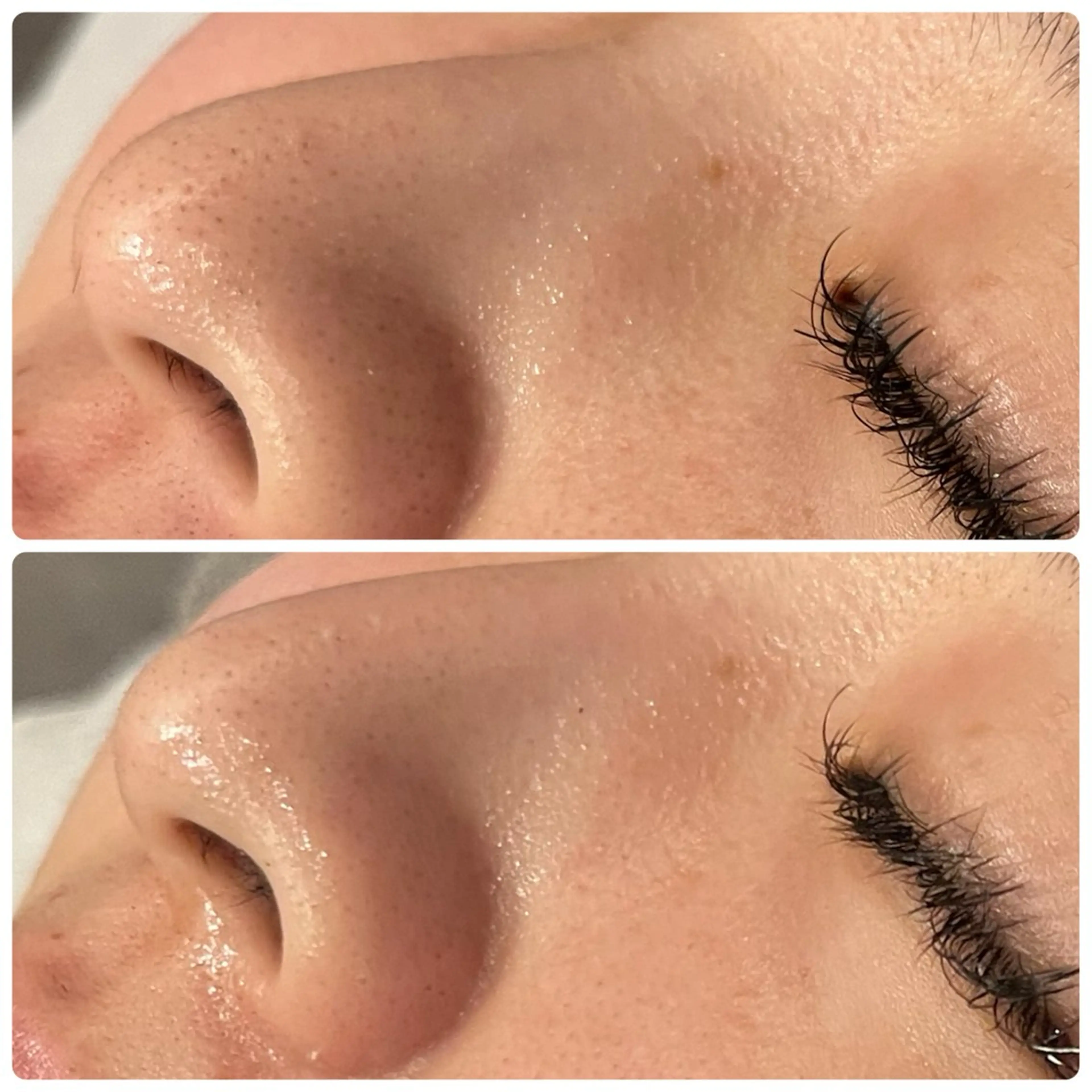 その他 yellow💛【 脱毛&フェイシャル】のエステ・リラクイメージ