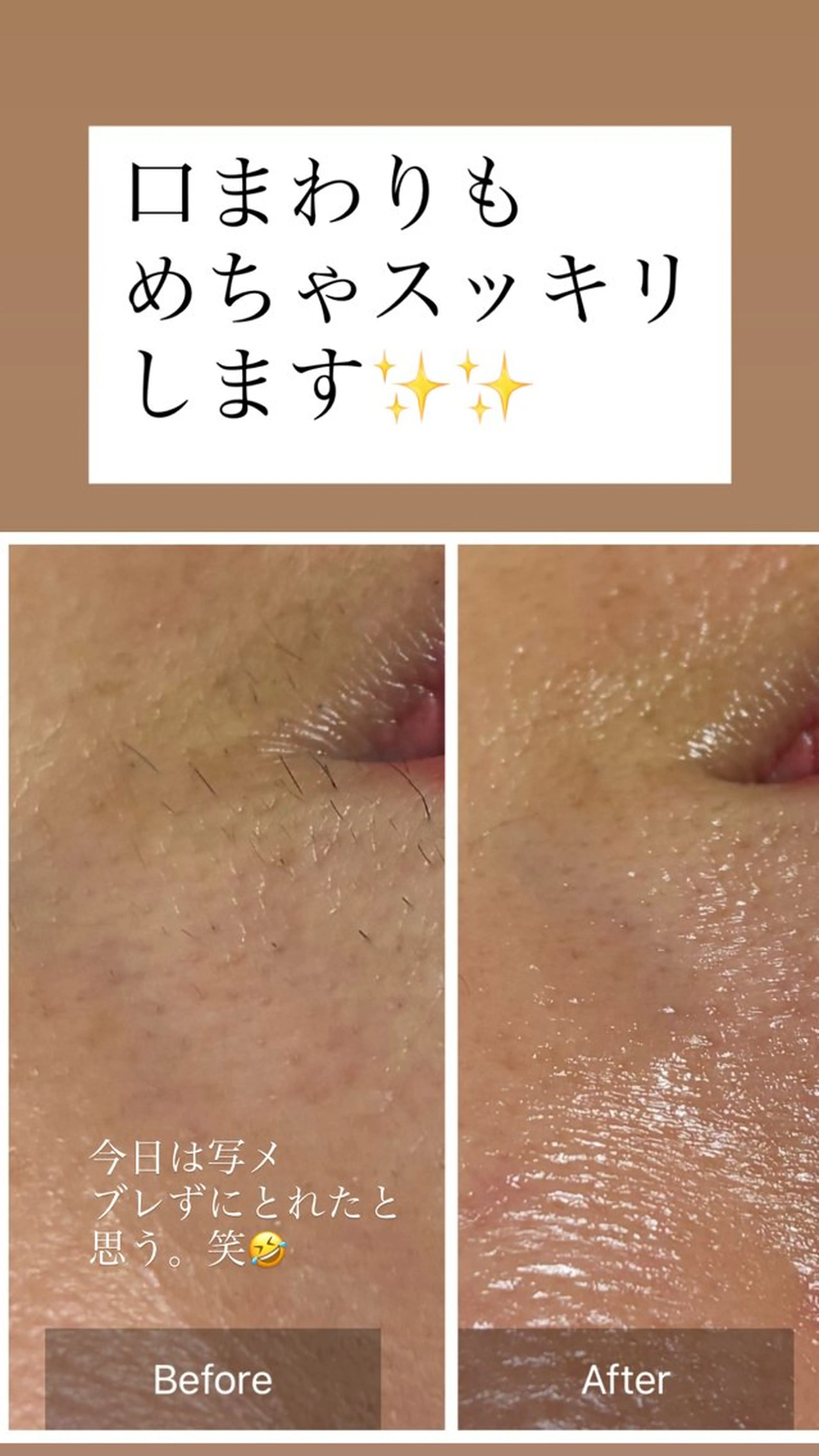 脱毛 産毛専門店 Bittoのエステ・リラクイメージ