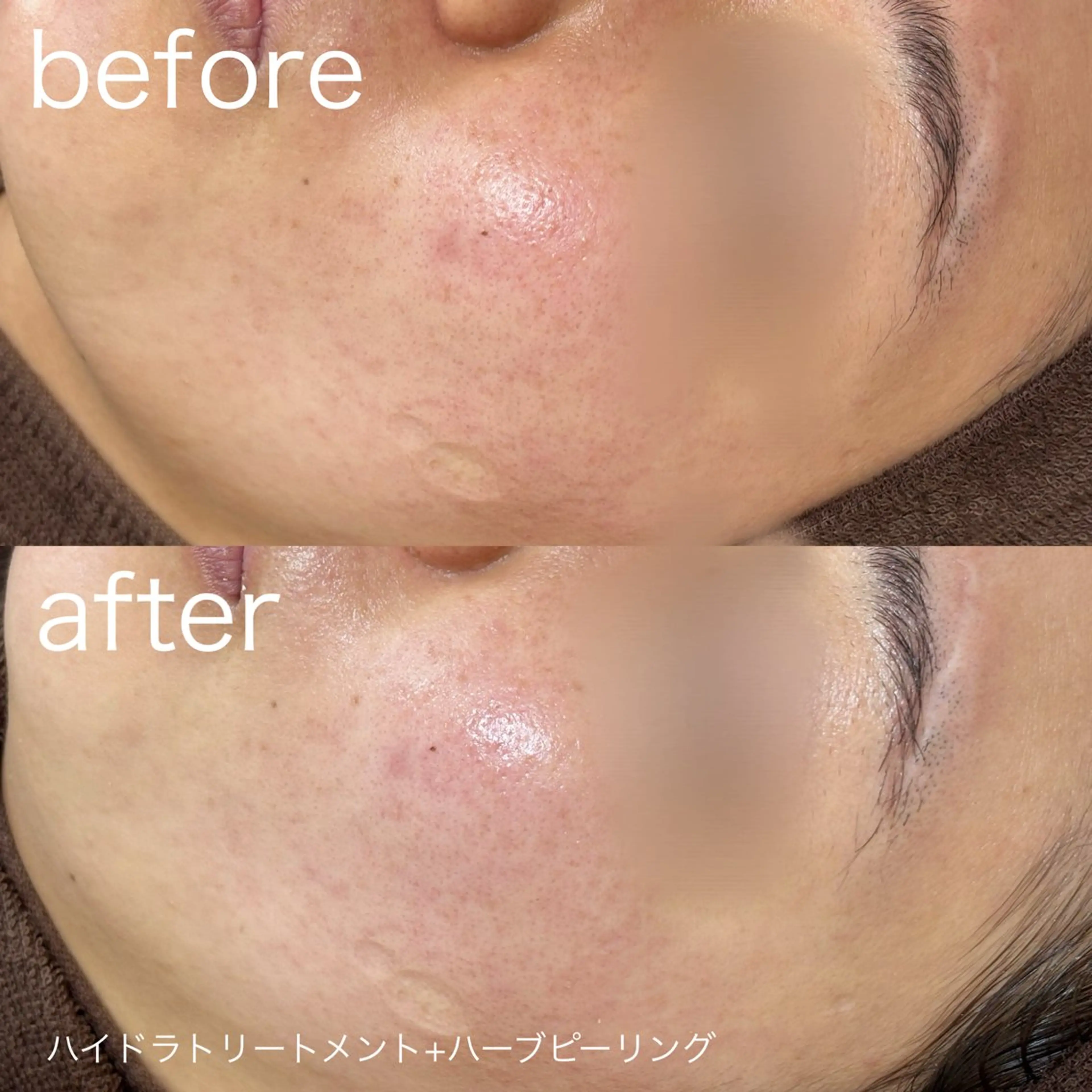 その他 lulularico Yuのエステ・リラクイメージ