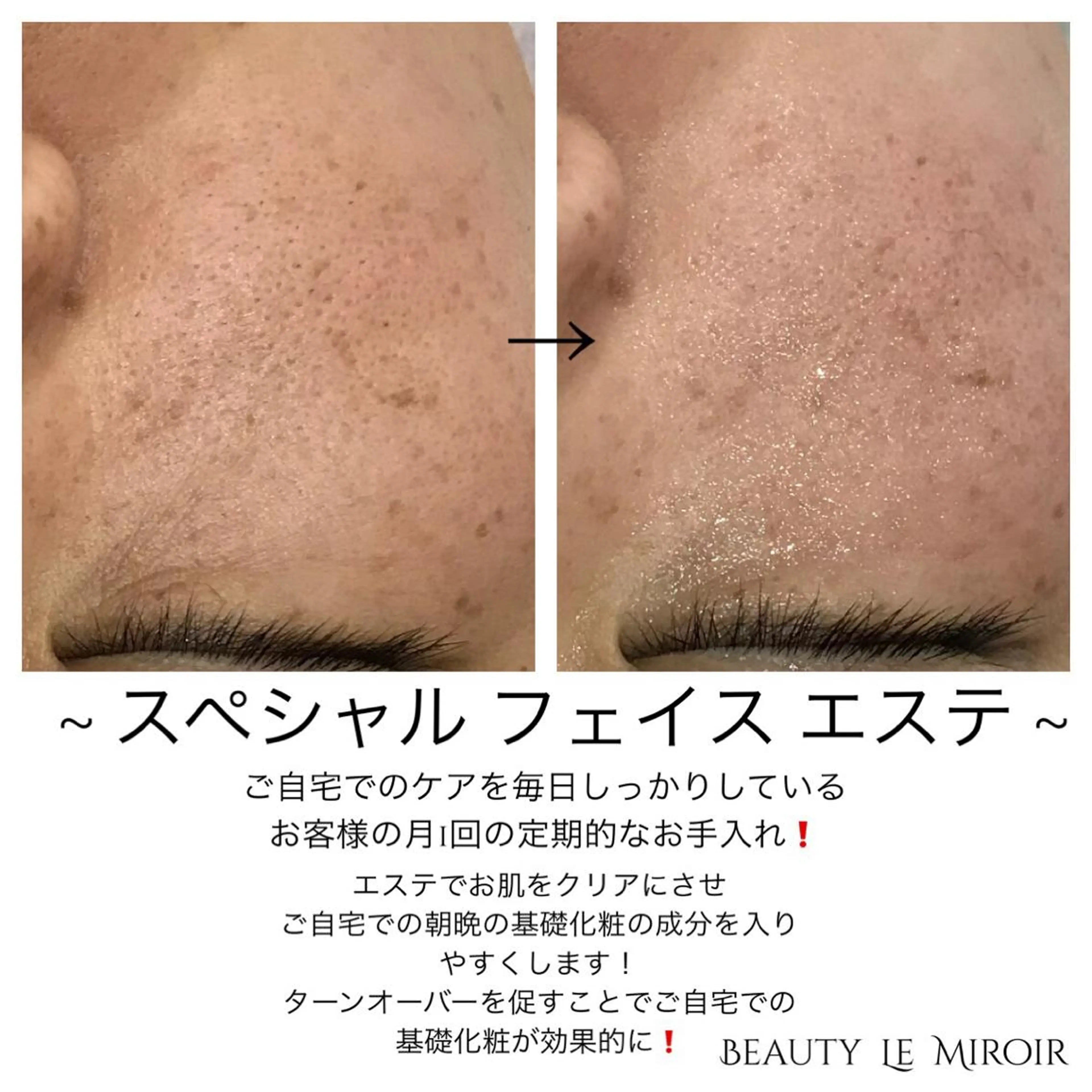 ビューティー ミロワールのエステ・リラクイメージ