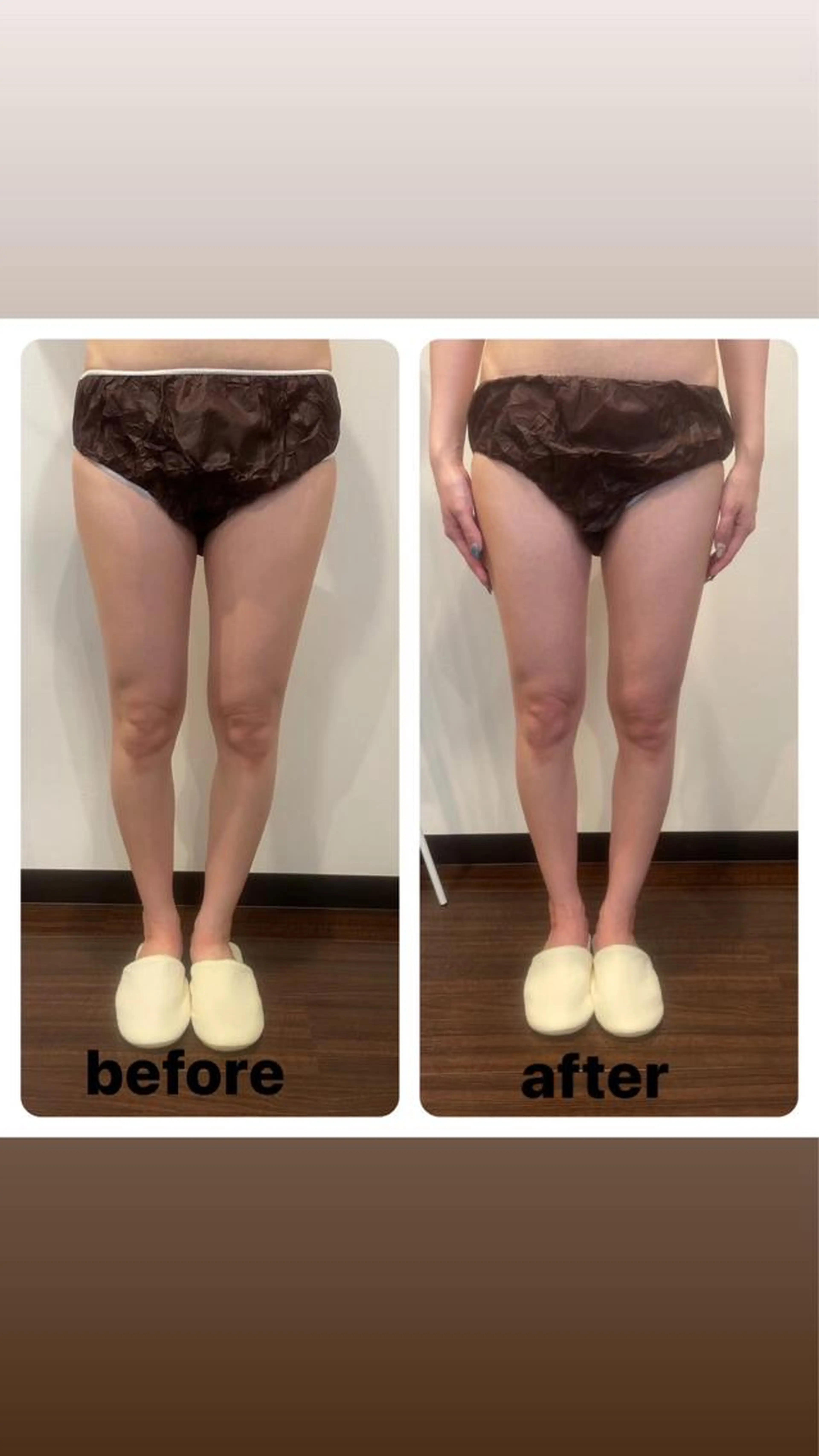 「限定口コミ&モニター限定体験価格」下半身ケア☺️美脚ヒップアップの写真