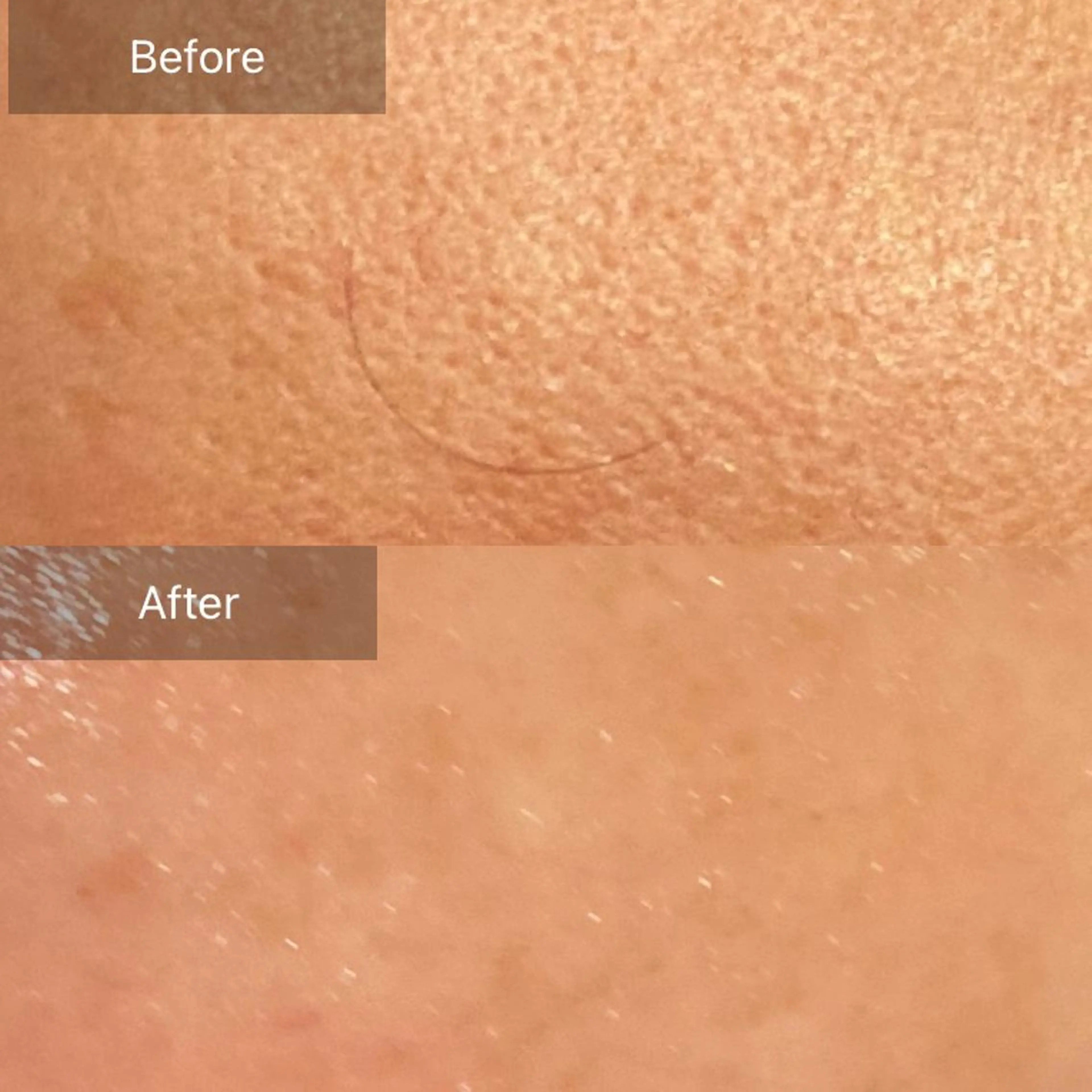 Mandarin Orange所属・毛穴から始める肌メン テマンダリンオレンジのエステ・リラクイメージ